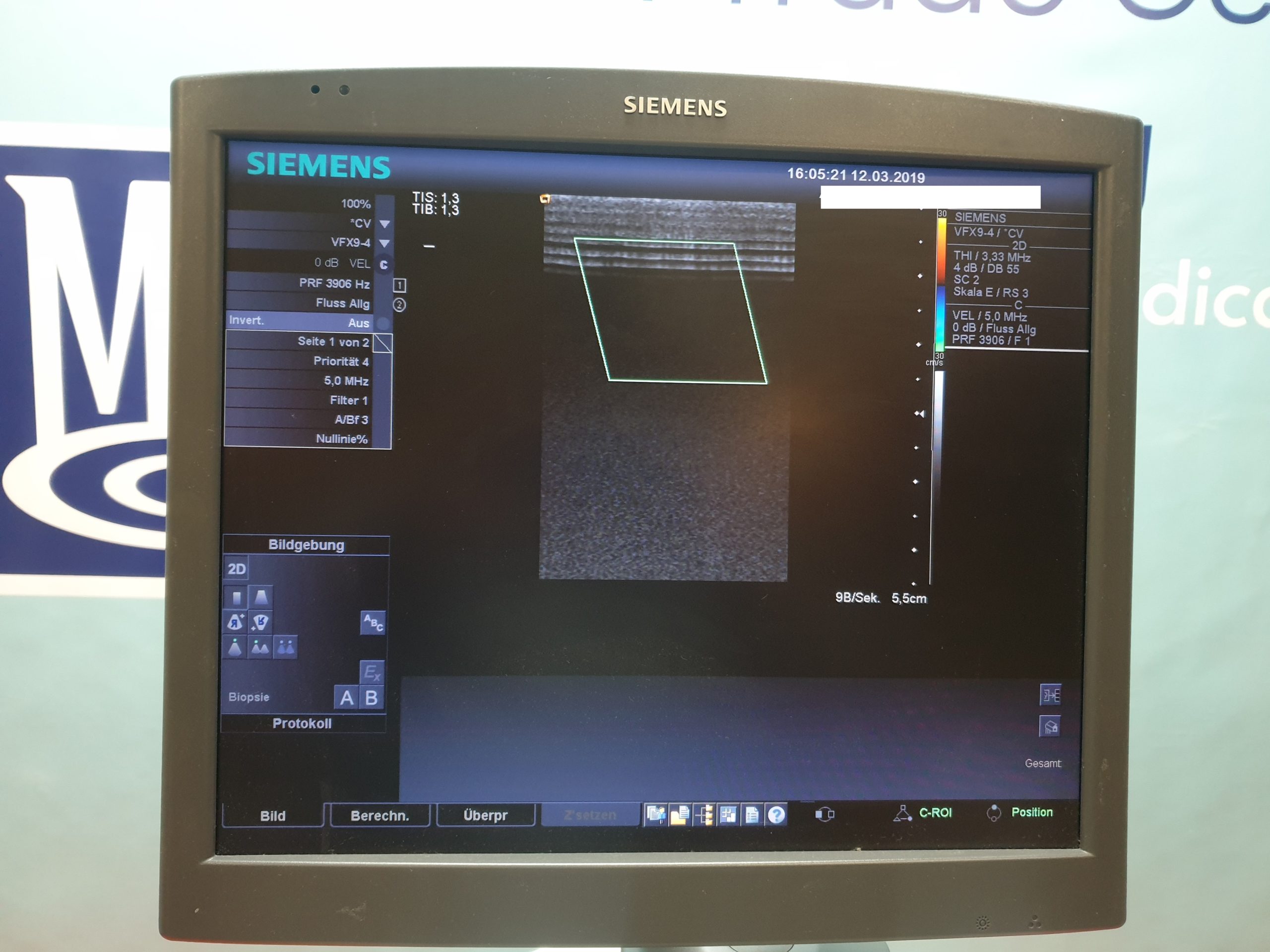 Siemens ACUSON Antares Ultraschallgerät // Kardio // Kardiomaschine mit 3 Sonden und Printer thumbnail 5
