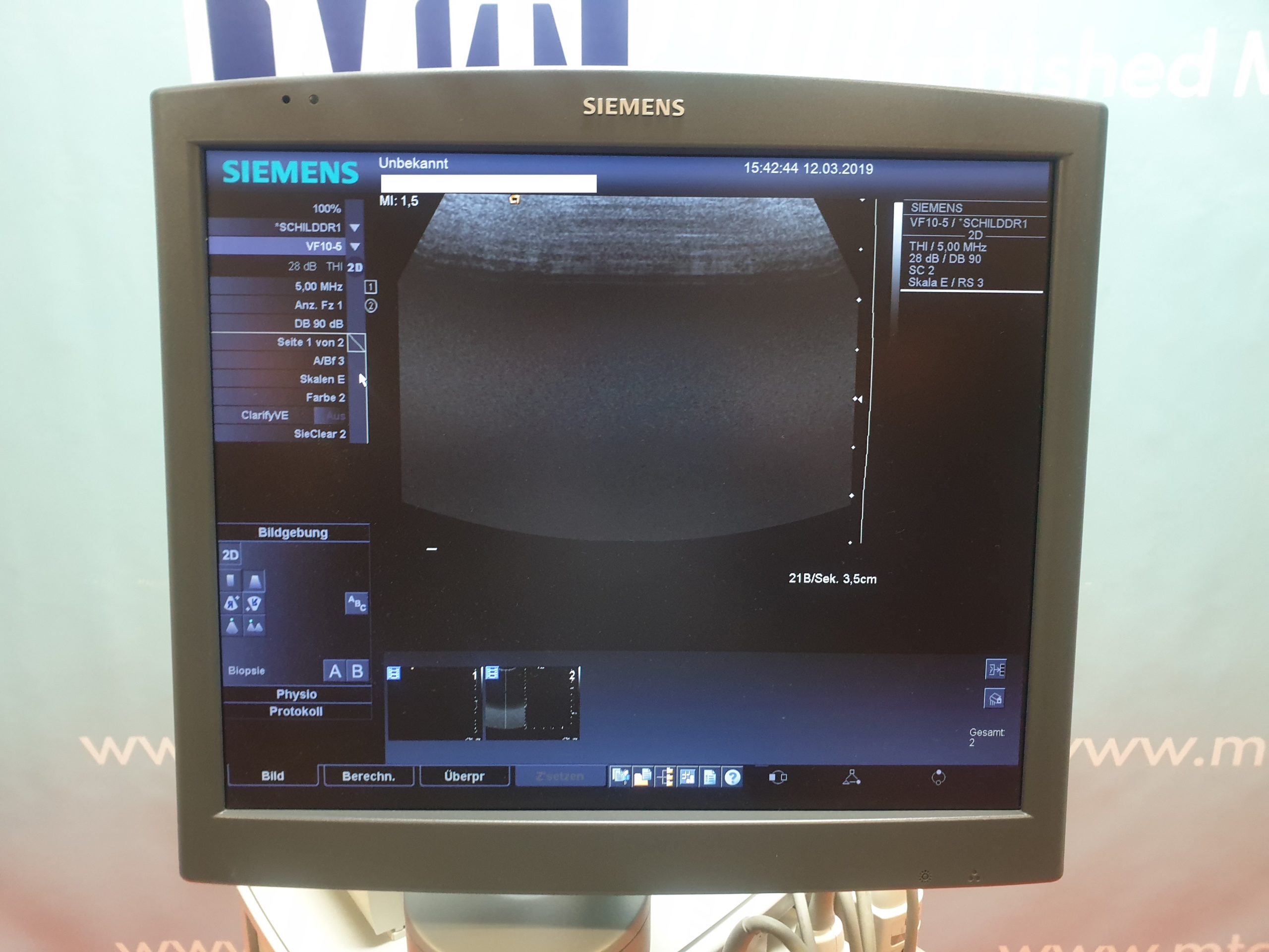 Siemens ACUSONn Antares Ultraschallgerät mit 3 Sonden, 02 Stiftsonden und Printer thumbnail 3