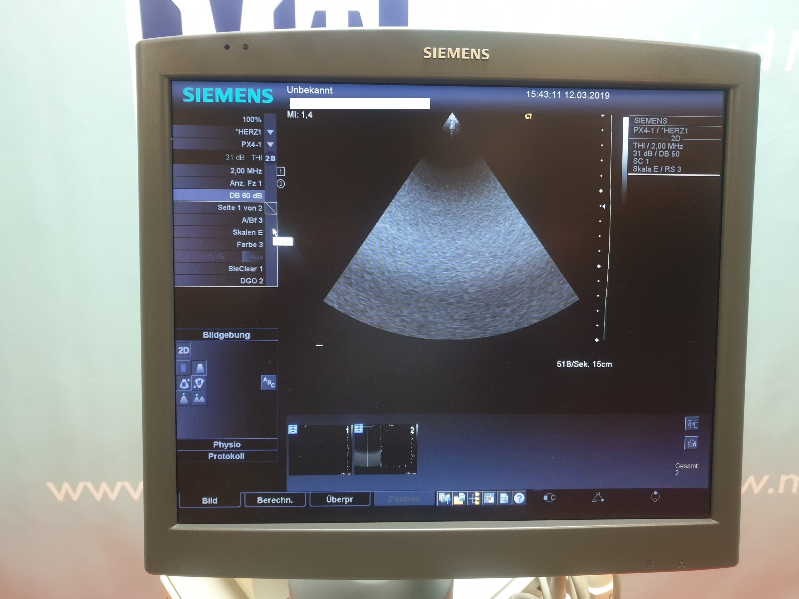 Siemens ACUSONn Antares Ultraschallgerät mit 3 Sonden, 02 Stiftsonden und Printer thumbnail 5
