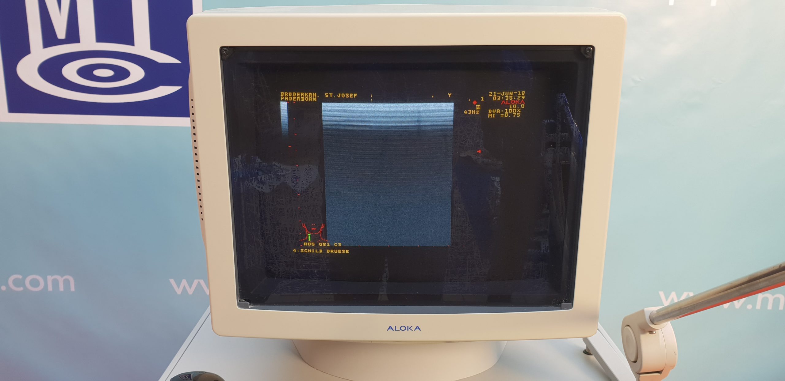 Aloka ProSound SSD-5000SV Ultraschallgerät mit Konvex und Linear thumbnail 2