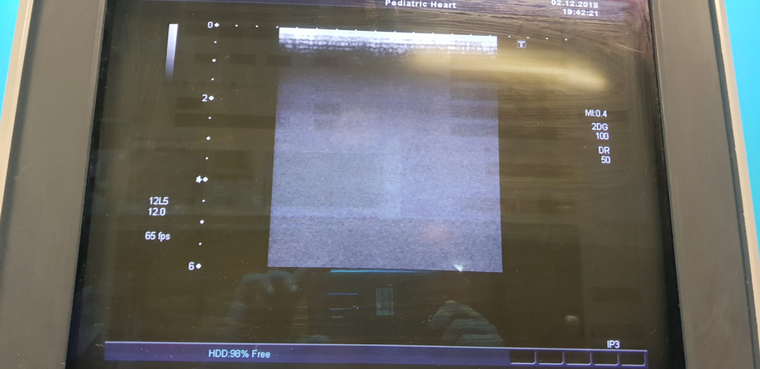 Toshiba Xario SSA 680A Ultraschallgerät mit 05 Sonden // Kardiomaschine // Pediatrie thumbnail 4