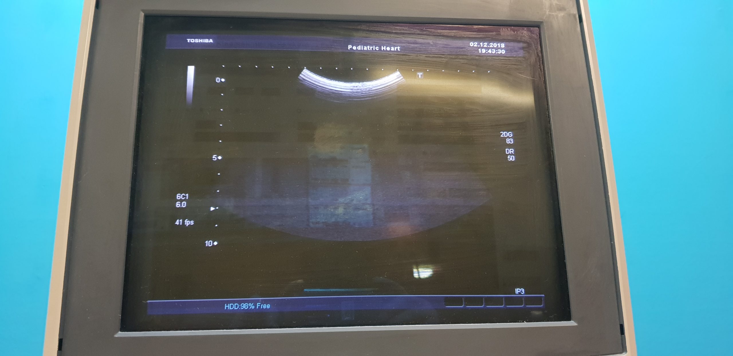 Toshiba Xario SSA 680A Ultraschallgerät mit 05 Sonden // Kardiomaschine // Pediatrie thumbnail 7