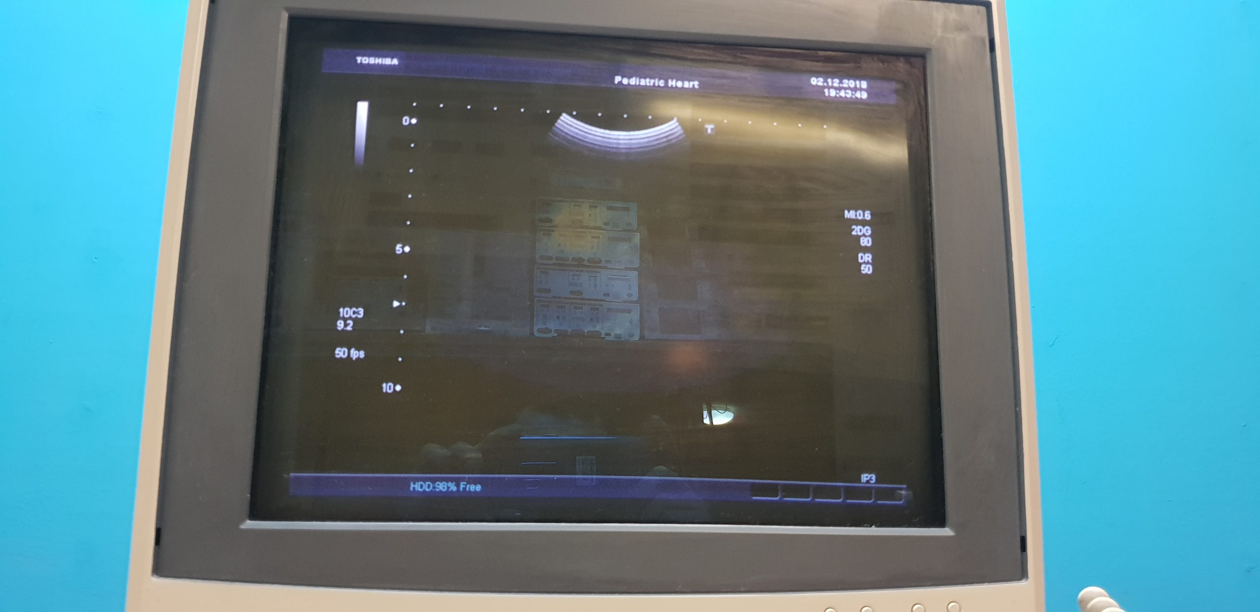 Toshiba Xario SSA 680A Ultraschallgerät mit 05 Sonden // Kardiomaschine // Pediatrie thumbnail 9