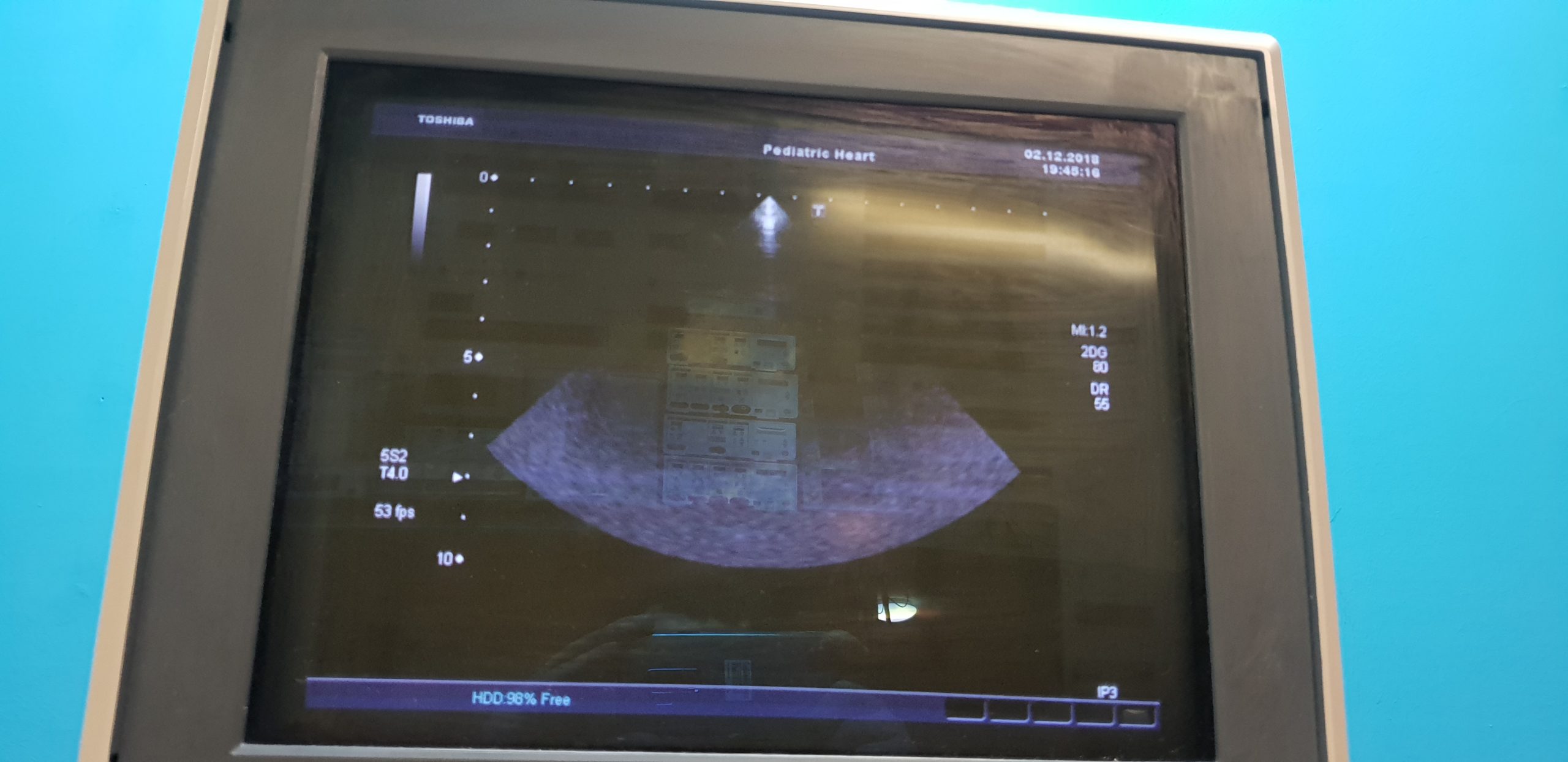 Toshiba Xario SSA 680A Ultraschallgerät mit 05 Sonden // Kardiomaschine // Pediatrie thumbnail 12