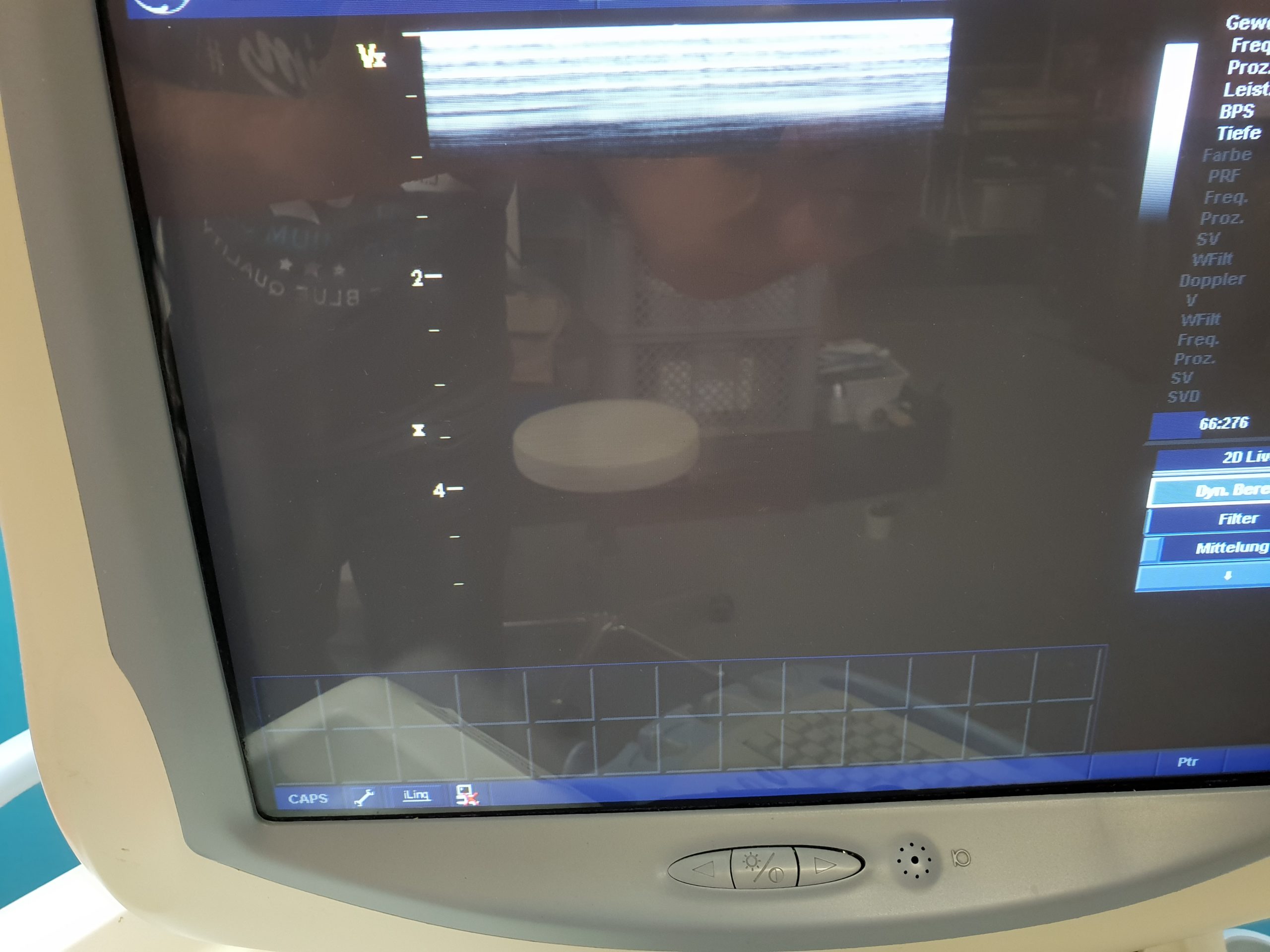 GE Vivid 7 Dimension Ultraschallgerät mit 3 Sonden, Printer und Videorekorder — image 1 of 1