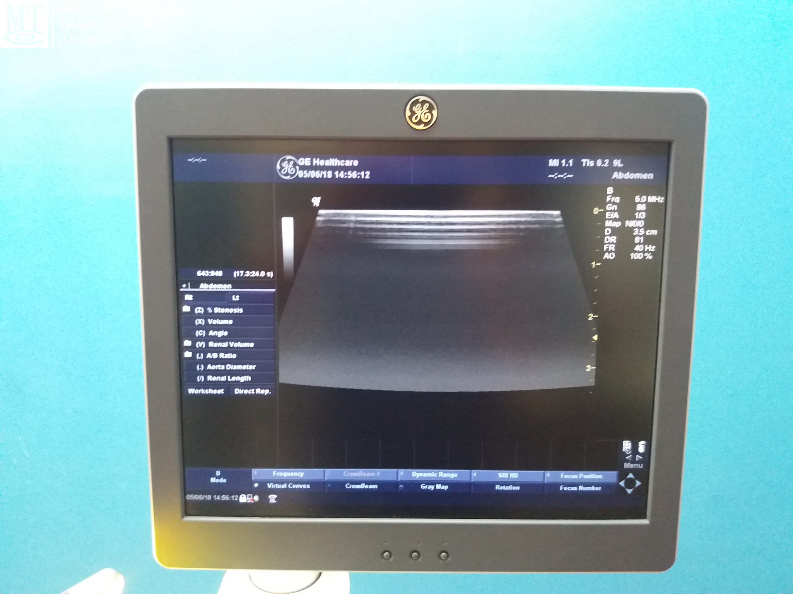 GE Logig P6 Premium BT11 mit Konvex, Linear und Printer thumbnail 3