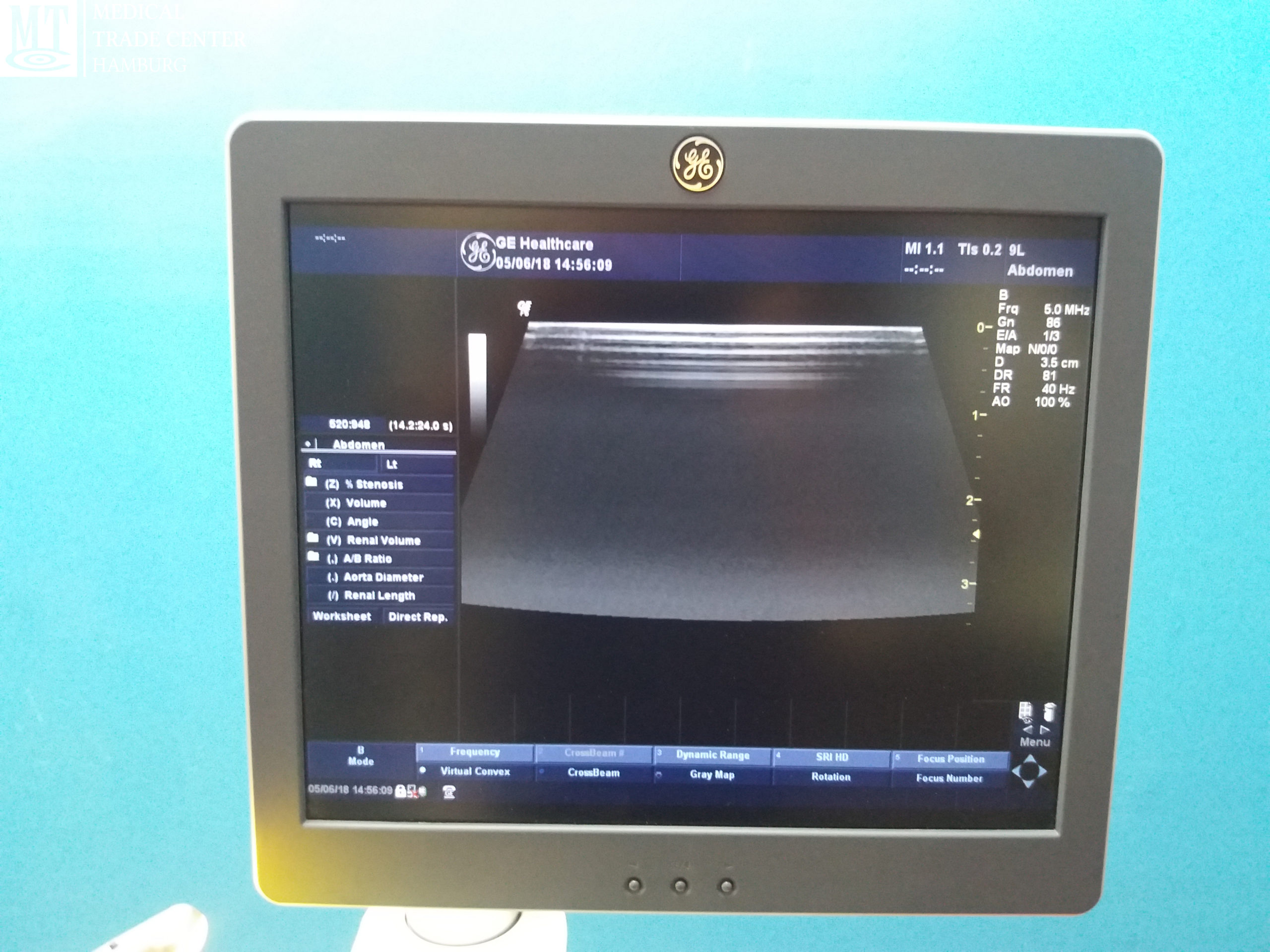 GE Medical 9L Ultraschallsonde // Probe Bj 2013 — image 1 of 1