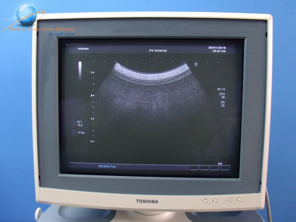 Toshiba Xario SSA-660A Ultraschall-Gerät Ultrasound thumbnail 2