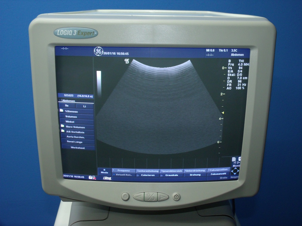 GE Logiq 3 Expert mit 3.5 C Konvex und LA39 Linear — image 1 of 2