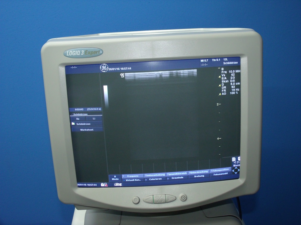 GE Logiq 3 Expert mit 3.5 C Konvex und LA39 Linear thumbnail 2