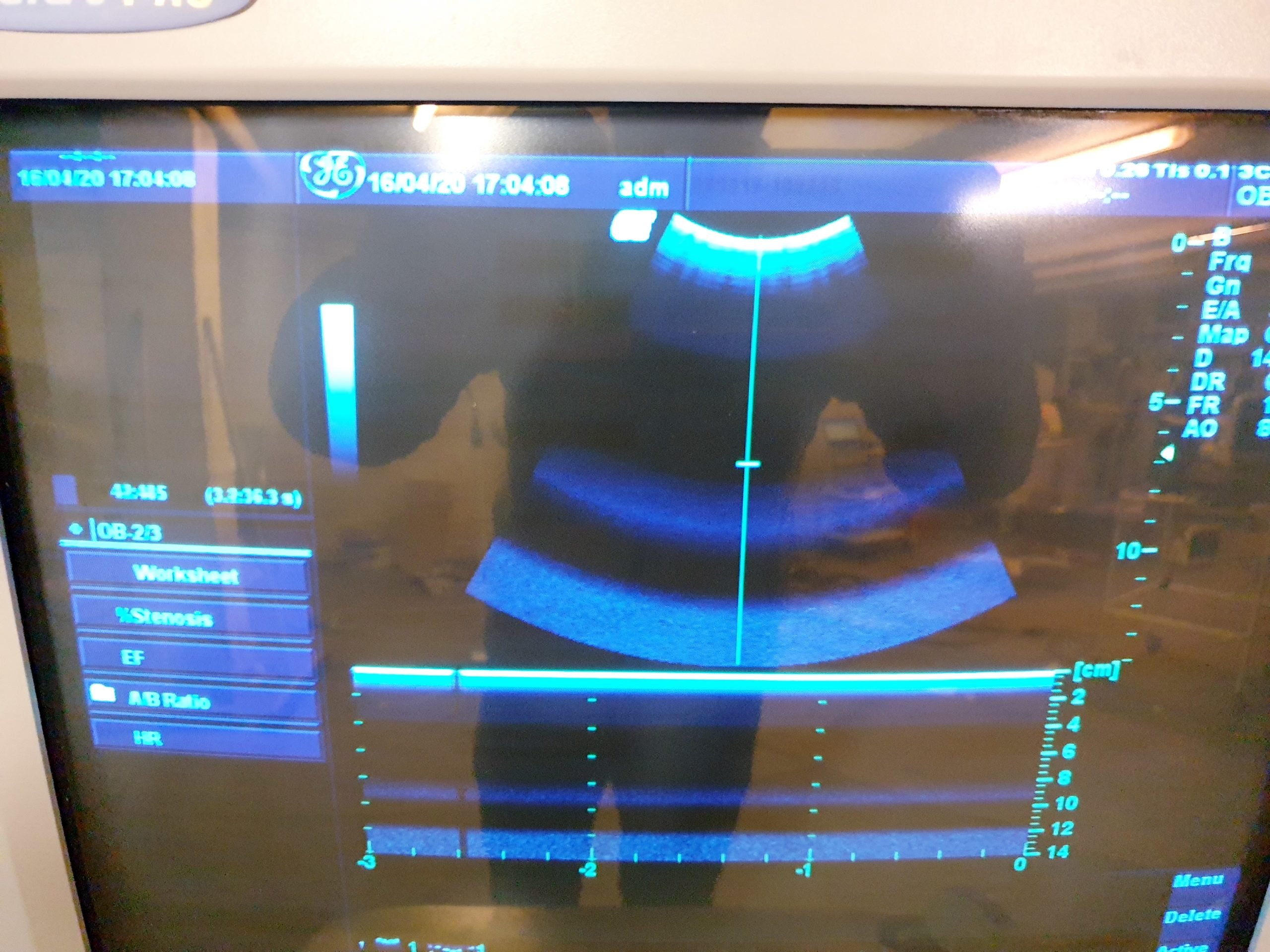 GE 3C Convex Array Ultrasound Transducer Probe thumbnail 4