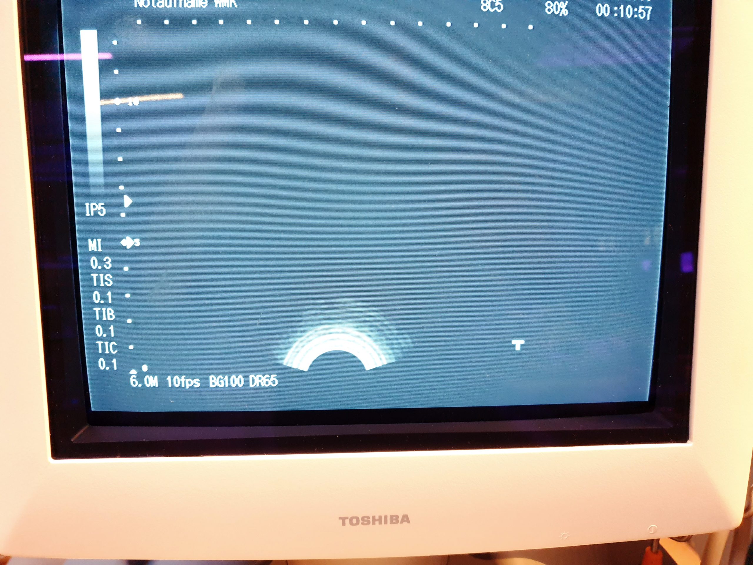 Toshiba PVQ-641V Endovaginal, Vaginal Probe thumbnail 5