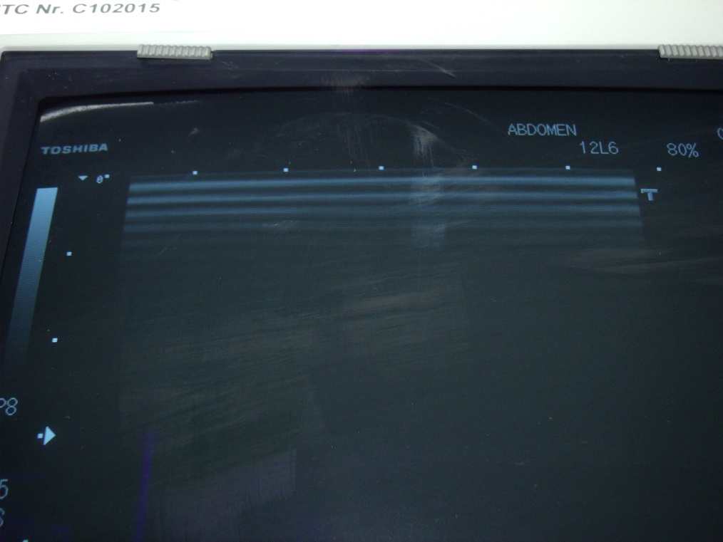 TOSHIBA PLQ-805A Ultrasound Transducer — image 1 of 2