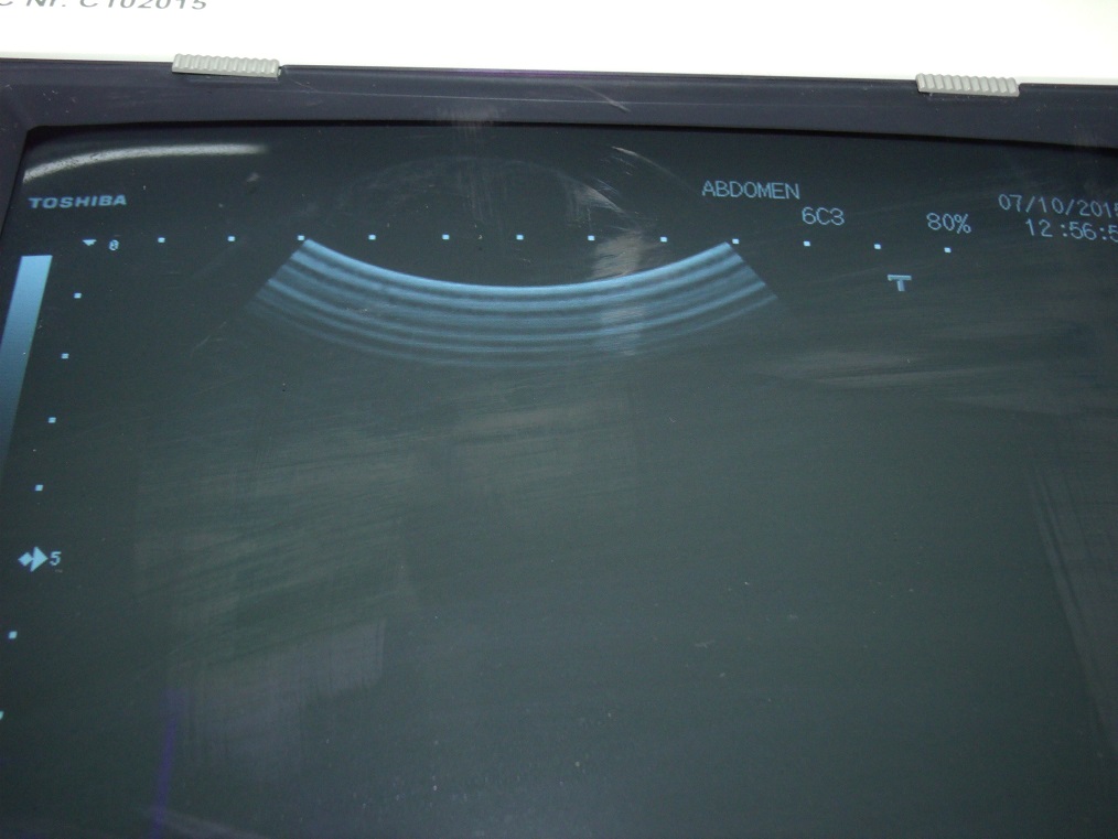 TOSHIBA PVQ-375A Ultrasound Transducer thumbnail 2