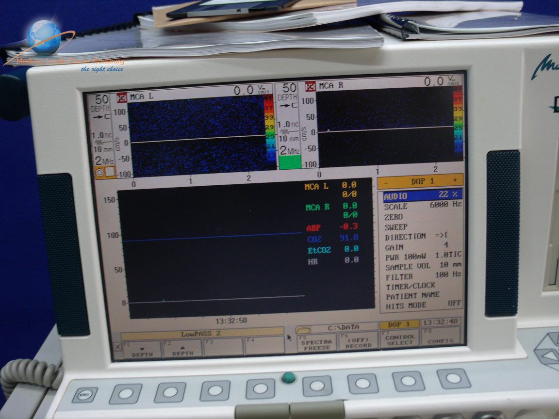 DWL – Multi Flow Doppler mit 03 Stiftsonden — image 1 of 1
