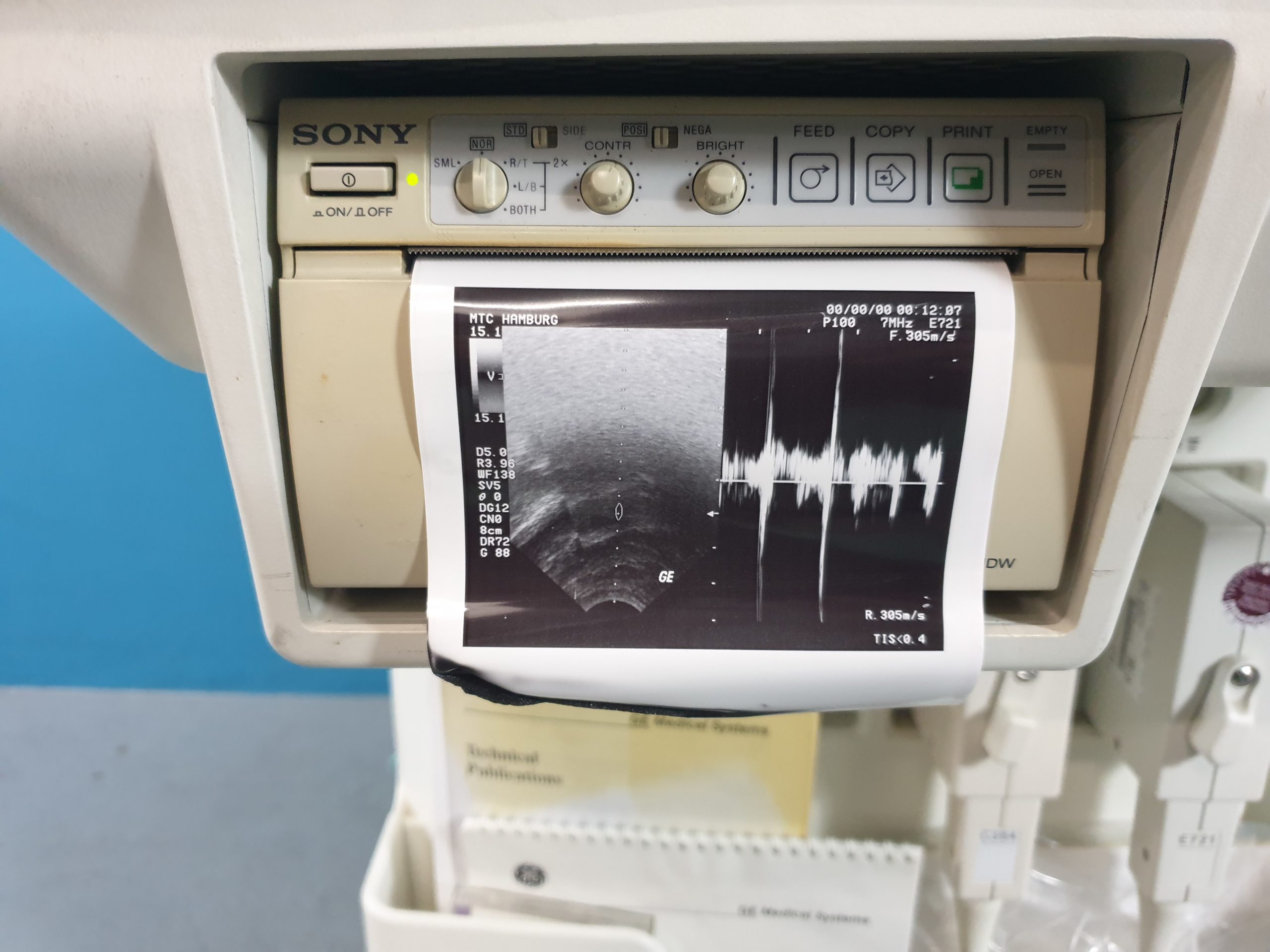 GE Logiq 400 Pro Farbdoppler mit Konvex und Endovaginal thumbnail 2