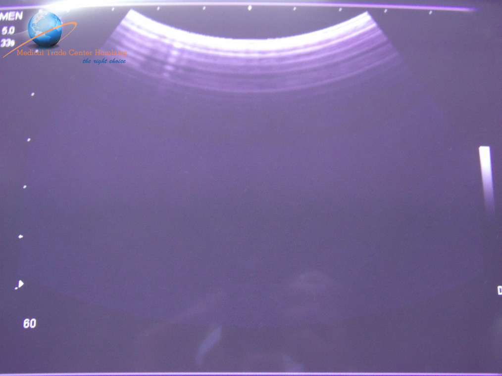 Siemens Sonoline C5-2 Convex Probe für die G Serie, G50, G60 — image 1 of 1