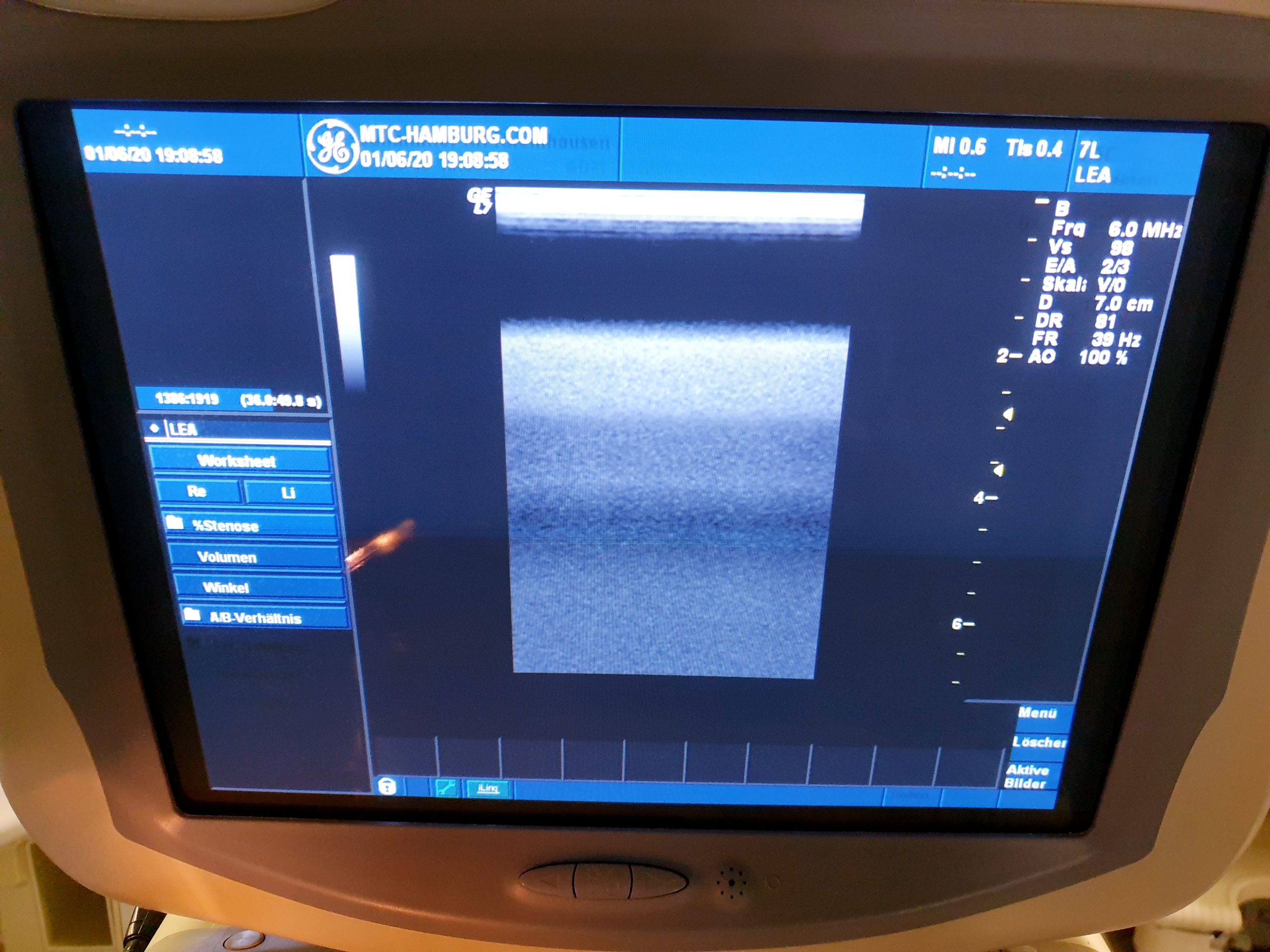 GE Linear 7L 2.5 – 10.0 MHz Schilddrüse Mamma Small Part thumbnail 4