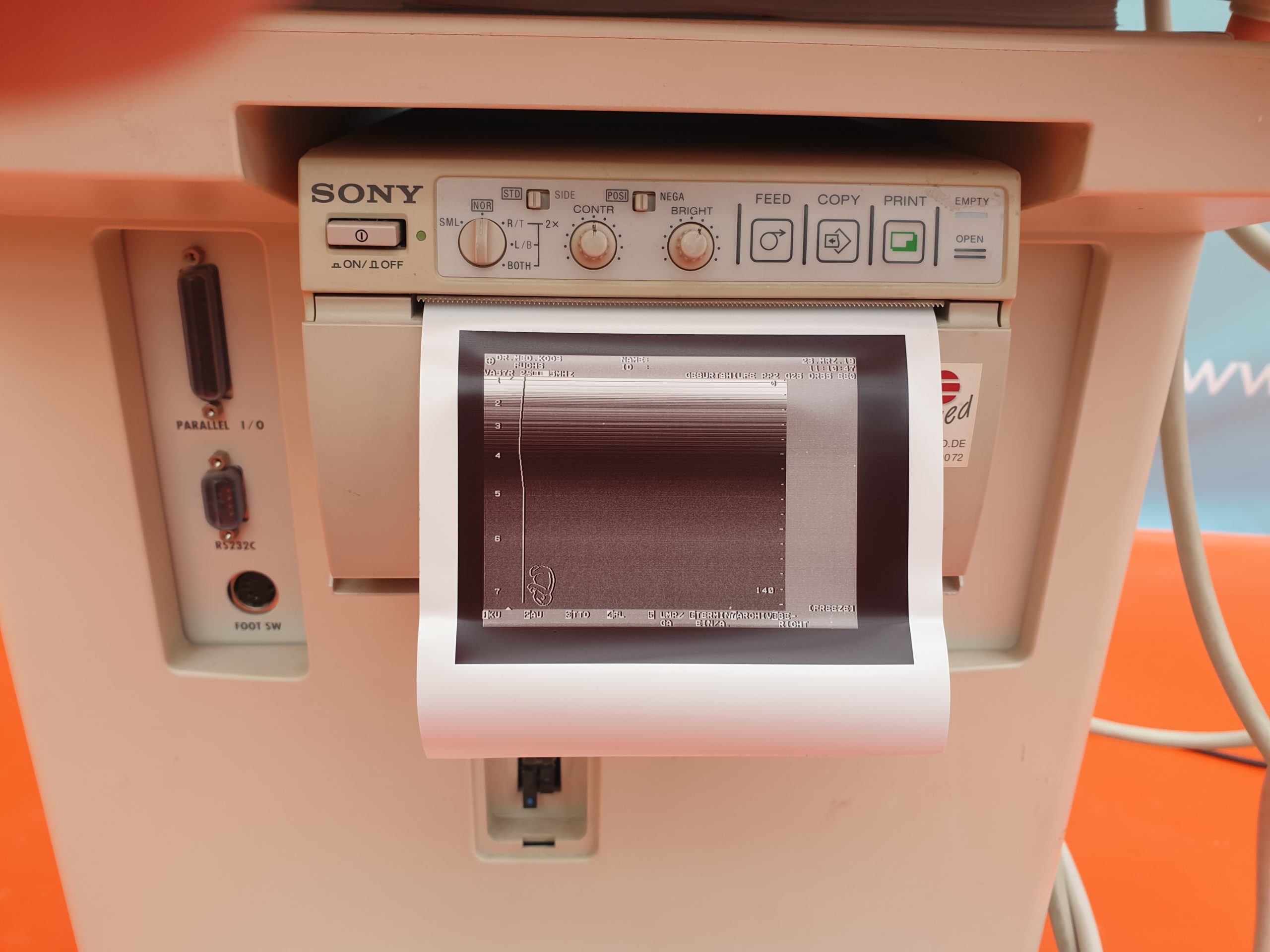 SHIMADZU SDU-450 Ultraschall Sonographie Gynäkologie thumbnail 4