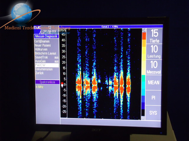 NICOLET Pioneer TC2020 Doppler Waveform Analyzer — image 1 of 2