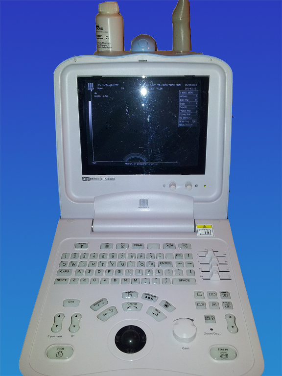 Ultraschallgerät Mindray DP-3300 s/w mit 1 Vaginalsonde — image 1 of 4