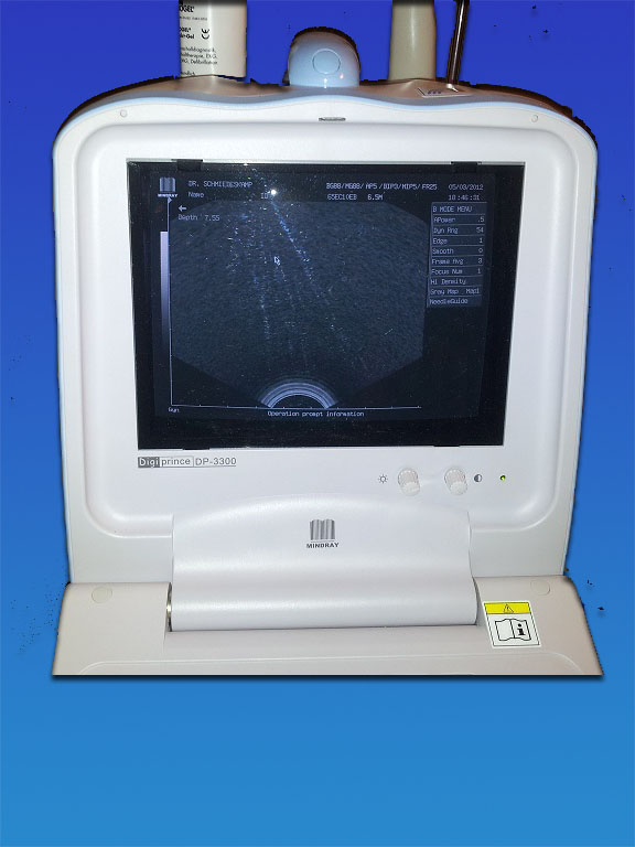 Ultraschallgerät Mindray DP-3300 s/w mit 1 Vaginalsonde thumbnail 4