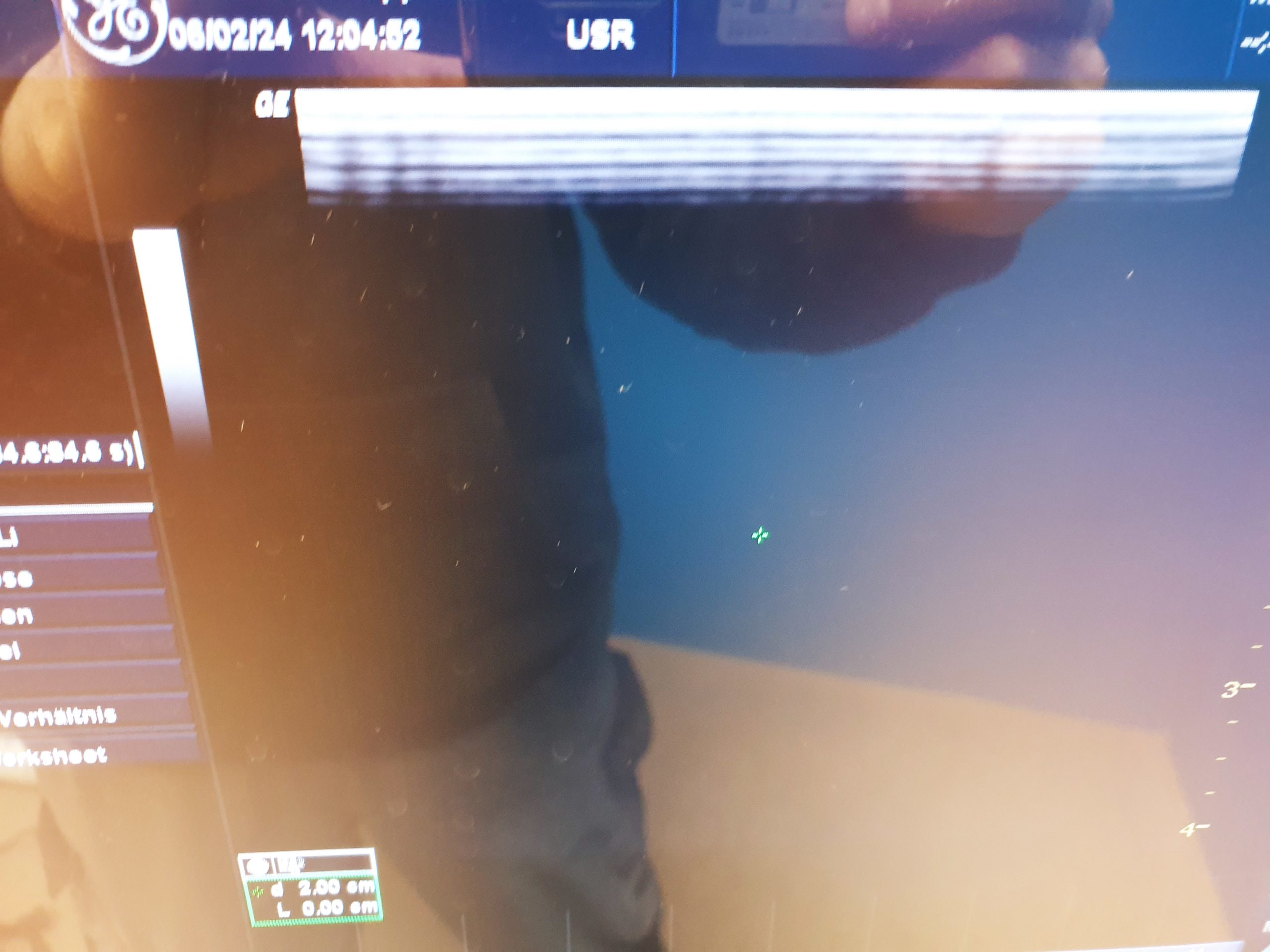 GE 10L 10 L Linear Schilddrüse Mamma thumbnail 5
