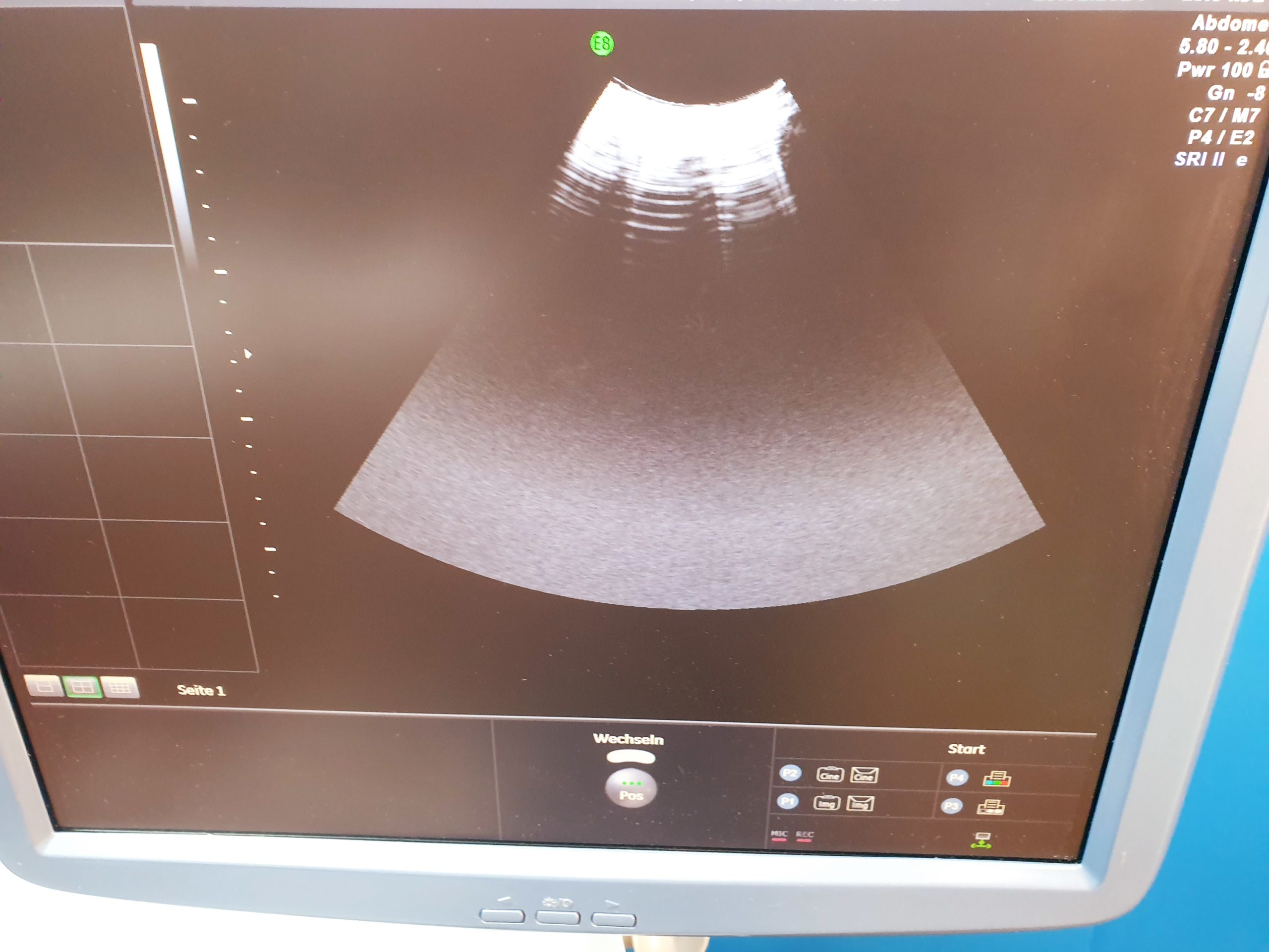 GE RAB 4-8-D Volumensonde 3D 4D Sonde thumbnail 3