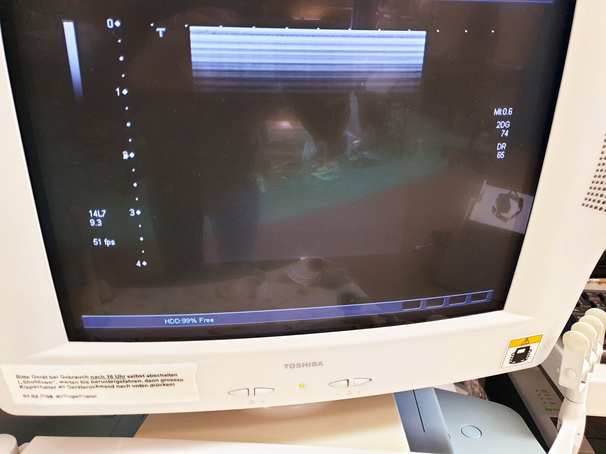 Toshiba PLT-1204AT // PLT 1204 AT Linear Ultraschallsonde thumbnail 2