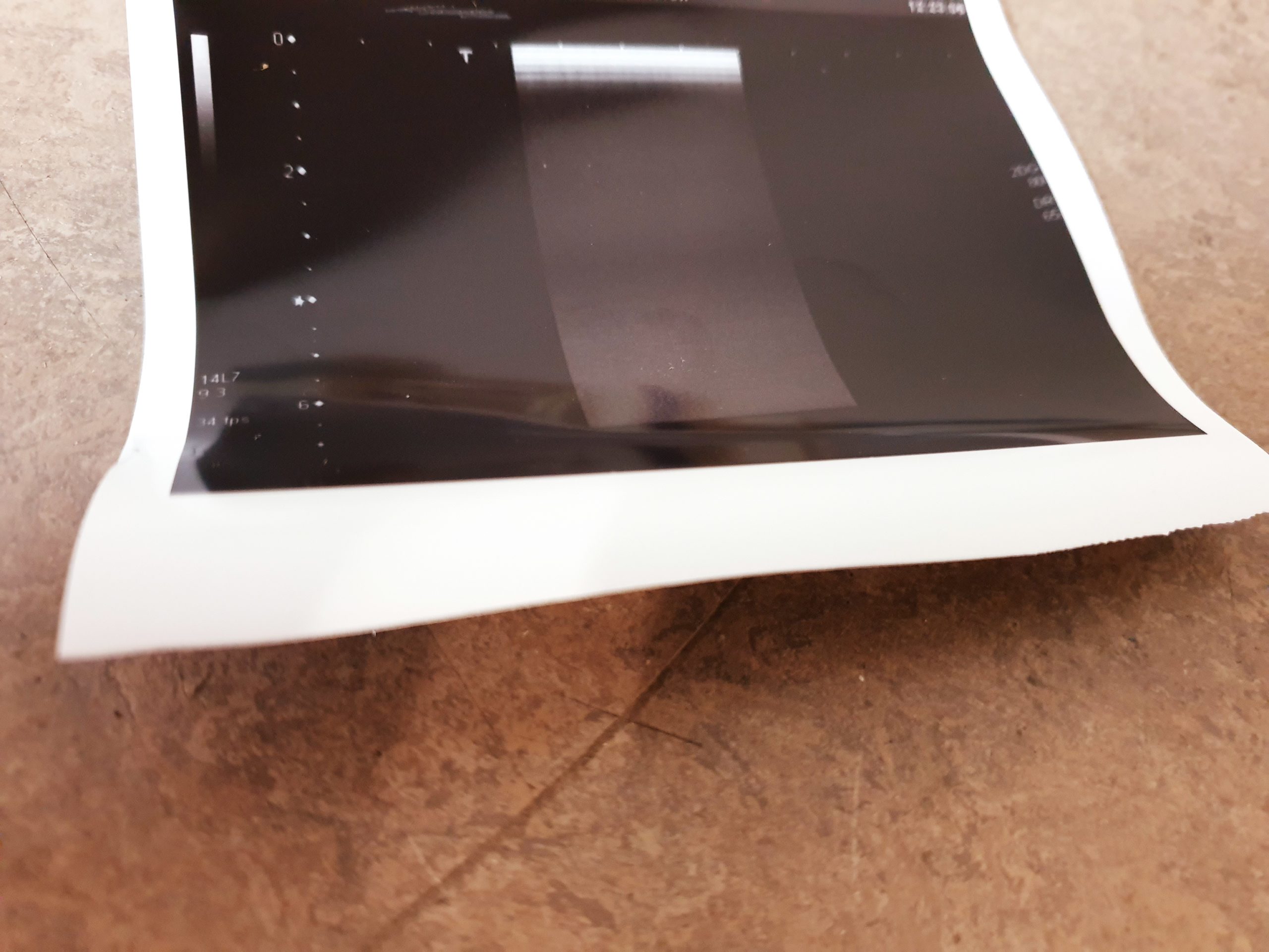 Toshiba PLT-1204AT // PLT 1204 AT Linear Ultraschallsonde thumbnail 6