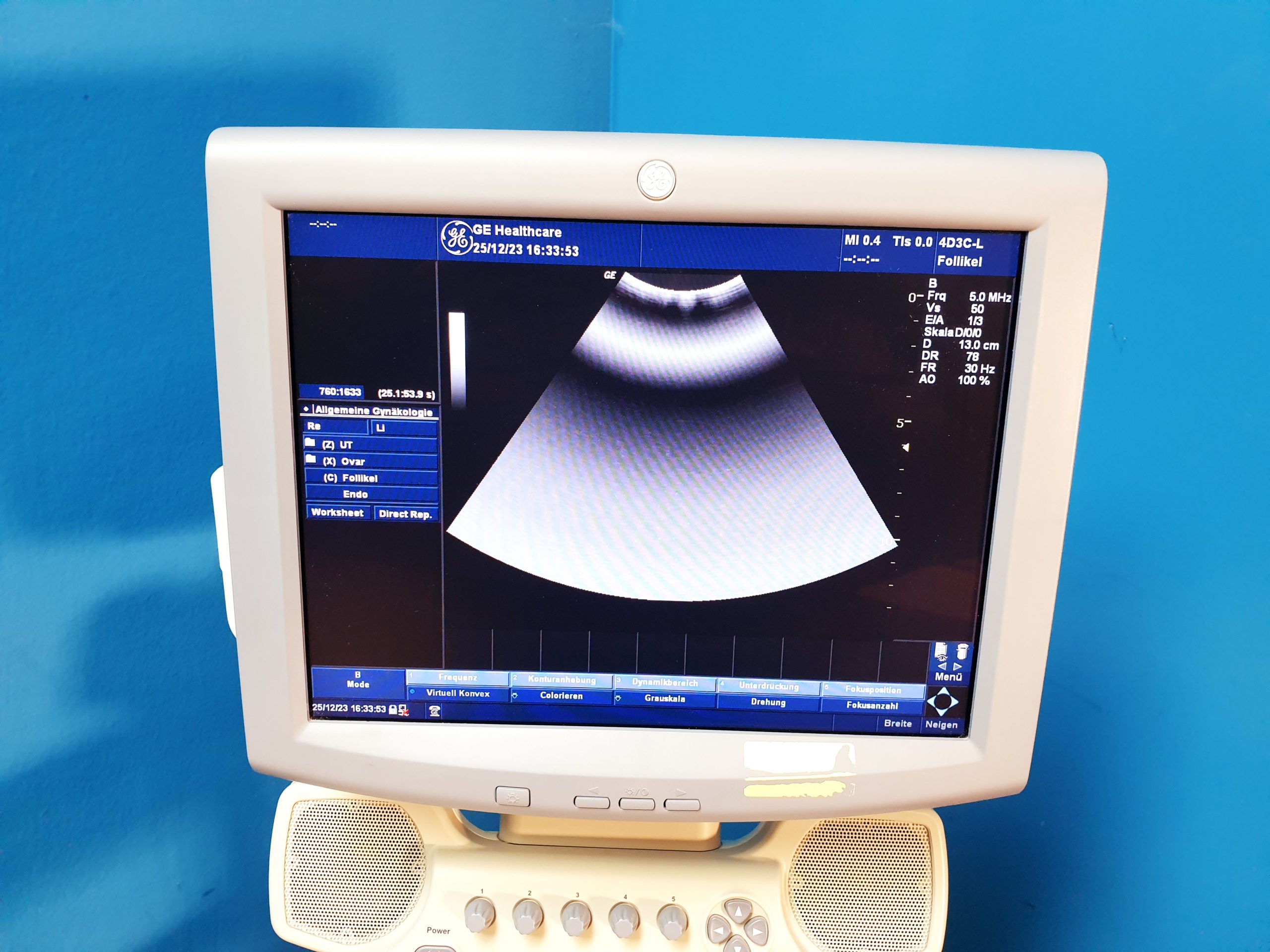 GE Logiq P5 – 4D3C-L + 12L 3D / 4D Ultraschallgerät thumbnail 3