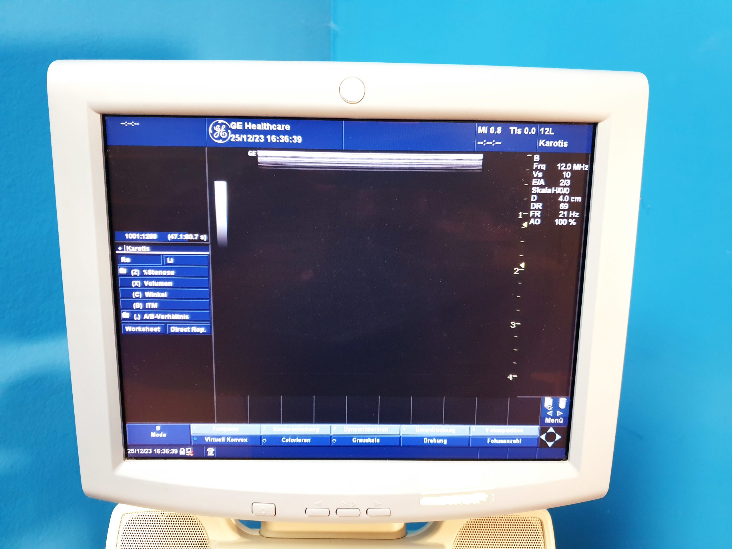 GE Logiq P5 – 4D3C-L + 12L 3D / 4D Ultraschallgerät thumbnail 6