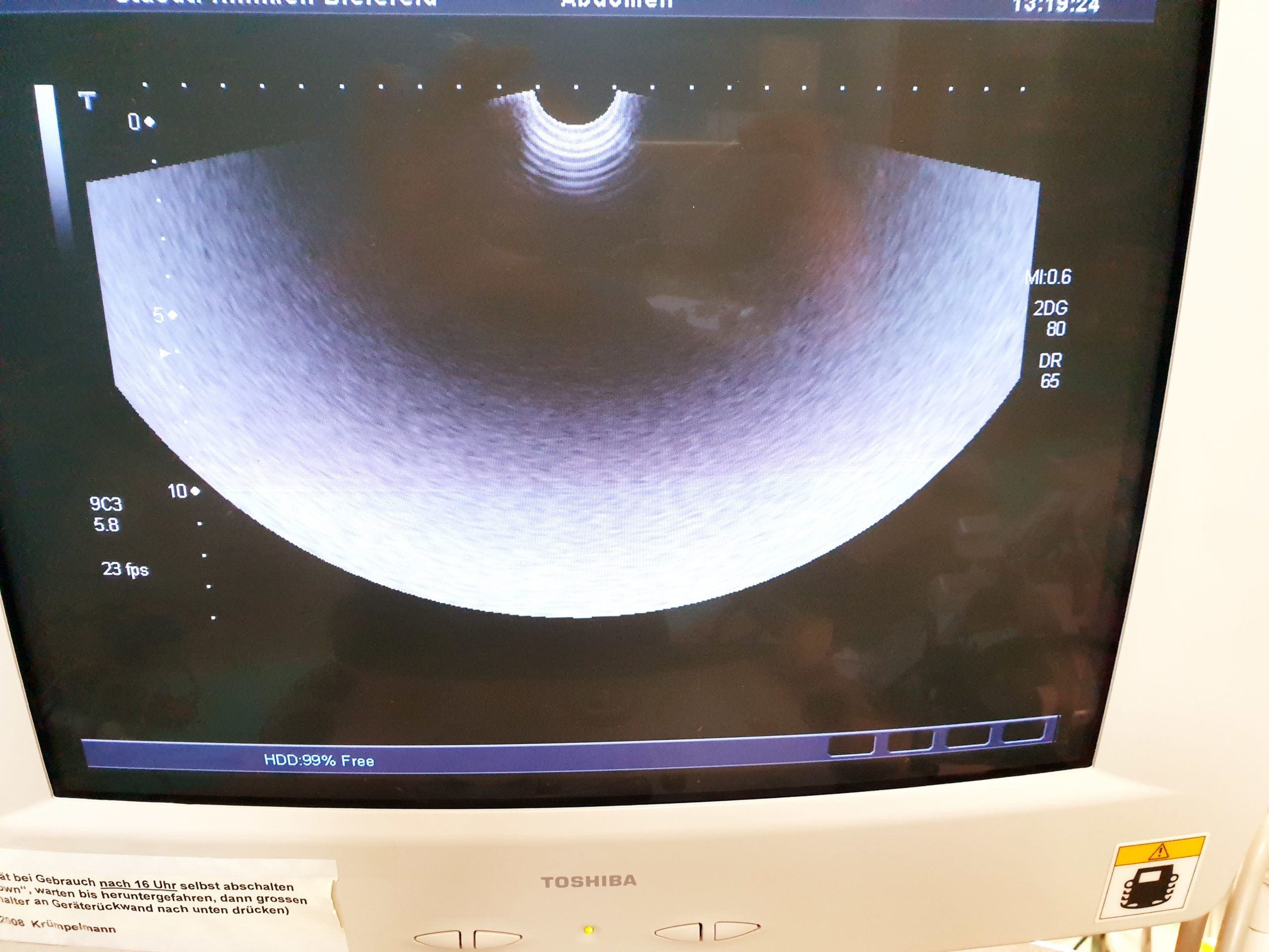 Toshiba PVT-661VT Transducer Ultrasound Probe thumbnail 2