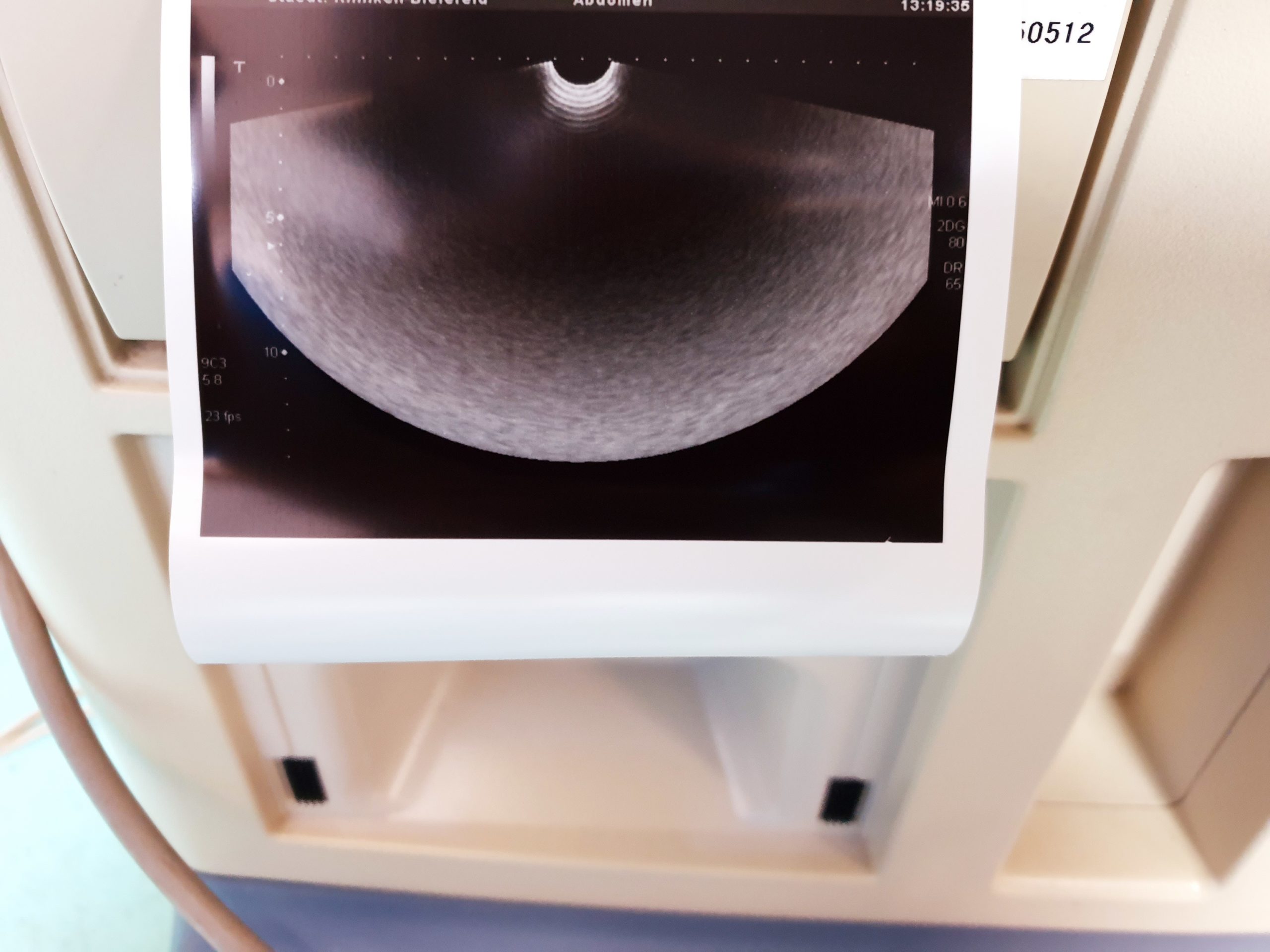 Toshiba PVT-661VT Transducer Ultrasound Probe thumbnail 4