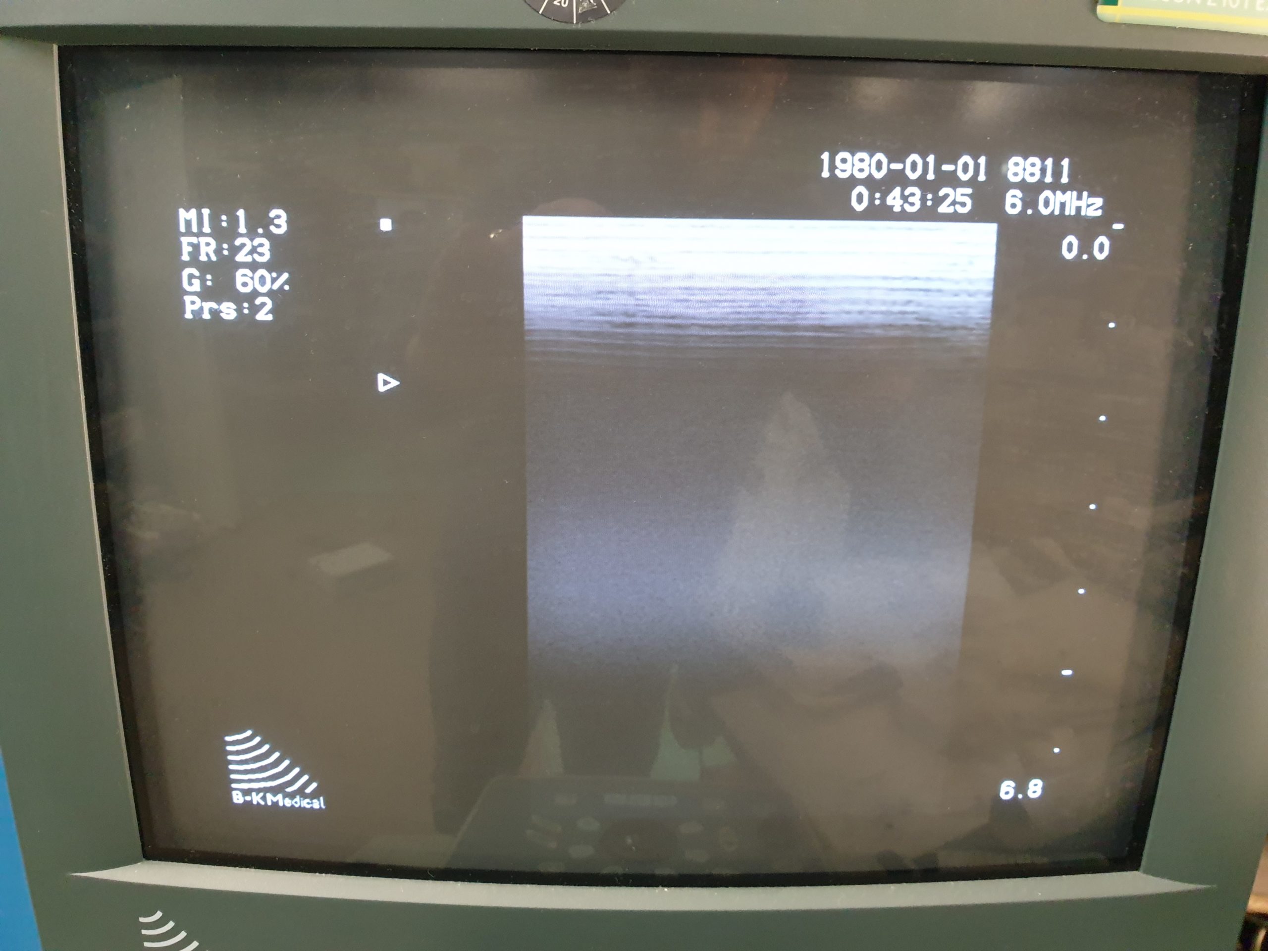 B&K BK 8811 Ultrasound Transducer thumbnail 3