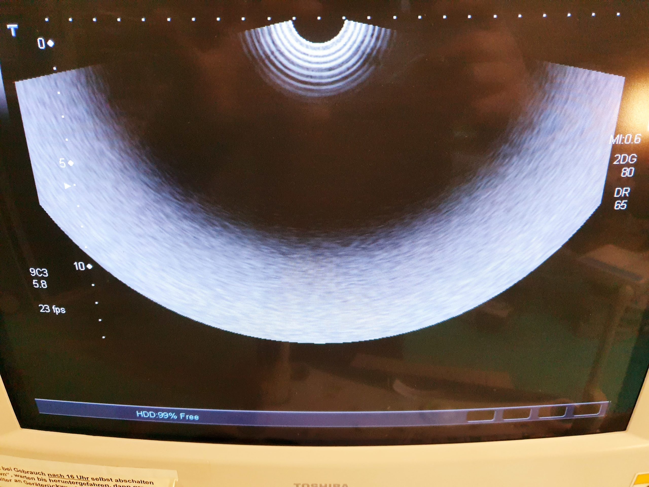 Toshiba PVT-661VT Transducer Ultrasound Probe thumbnail 3