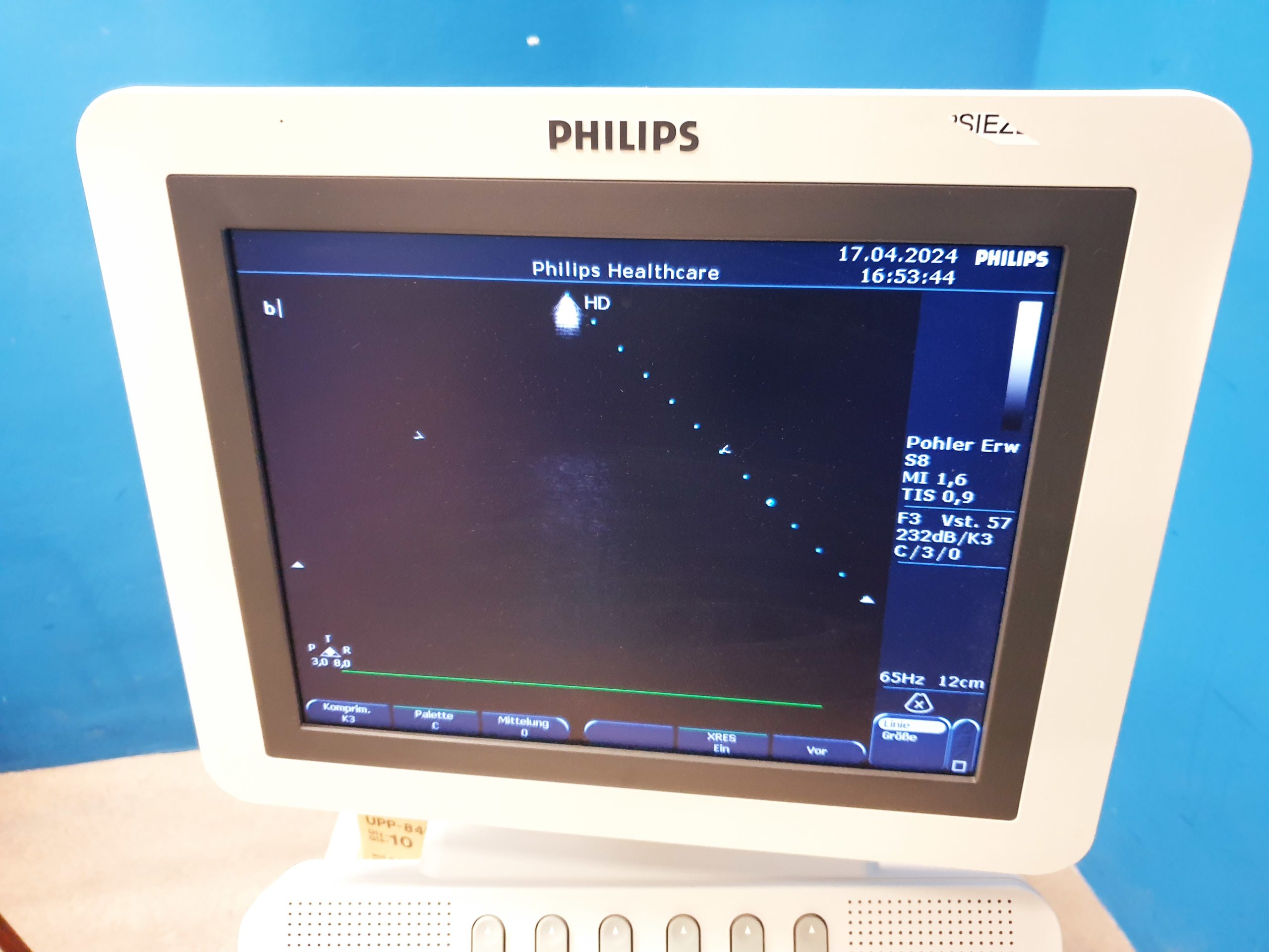 Philips S8 Sektor Ultraschallsonde — image 1 of 6