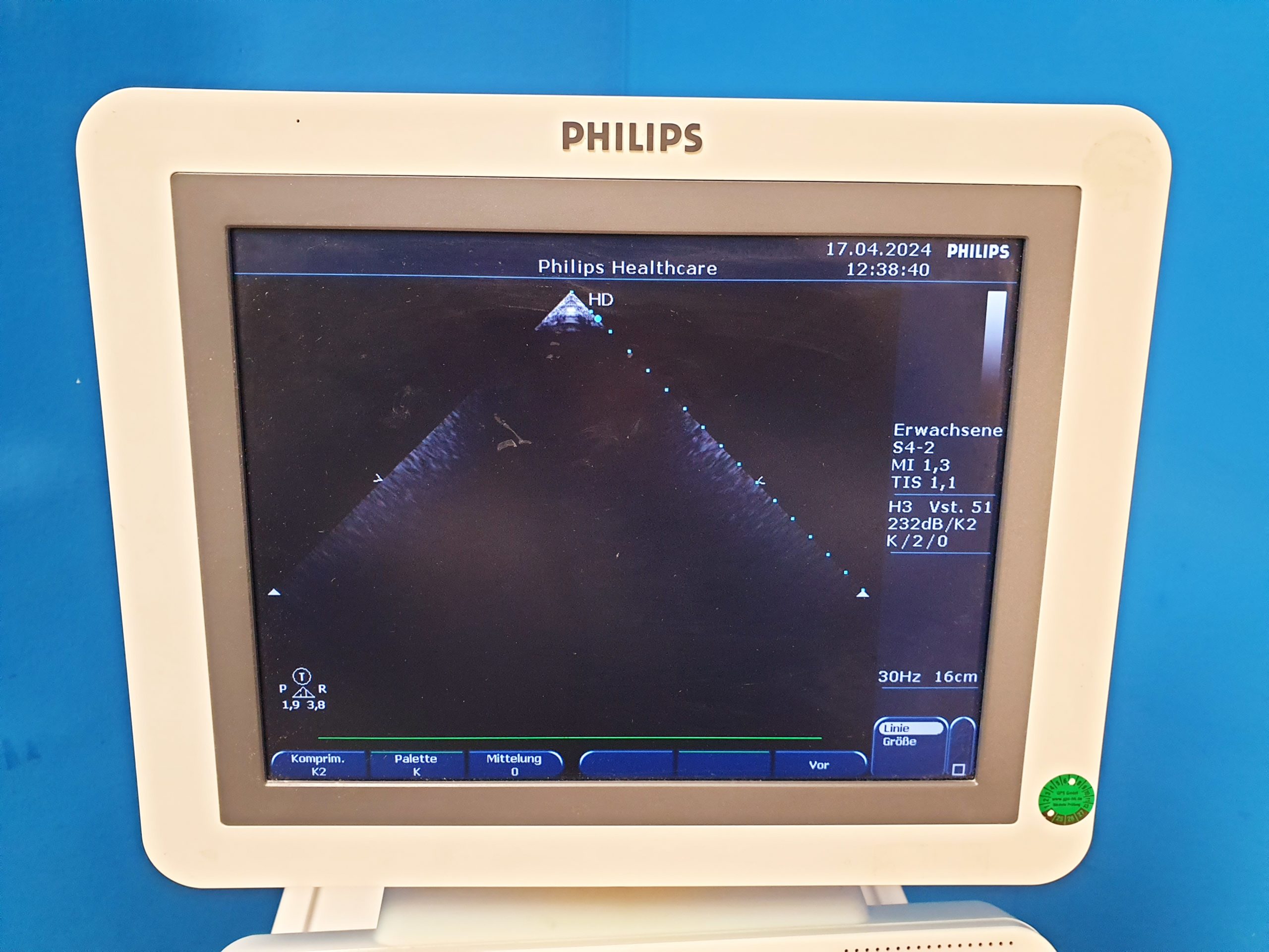 Philips HD7 Ultraschallgerät + S4-2 + L12-3 – Kardiomaschine thumbnail 4