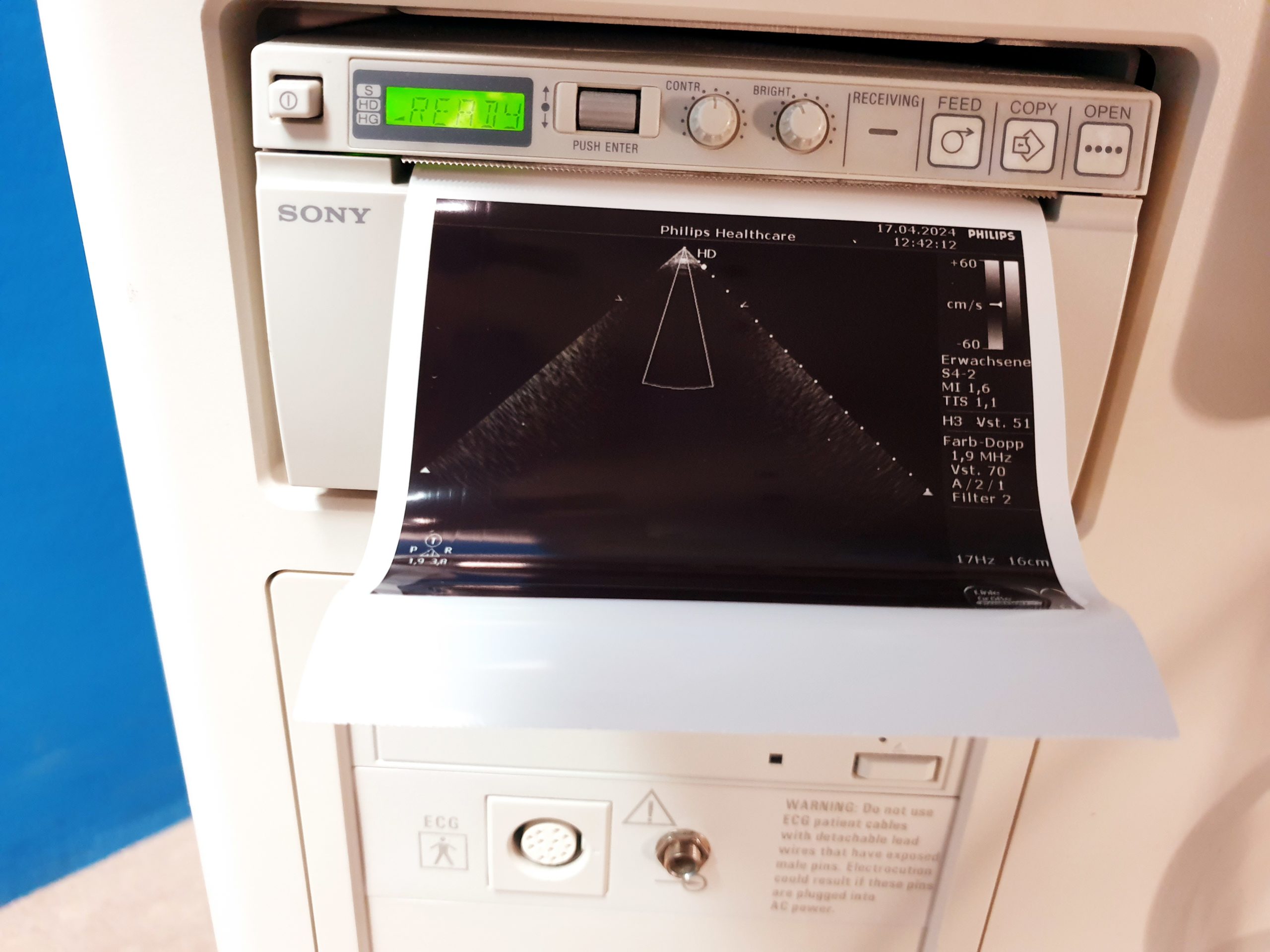 Philips HD7 Ultraschallgerät + S4-2 + L12-3 – Kardiomaschine thumbnail 5