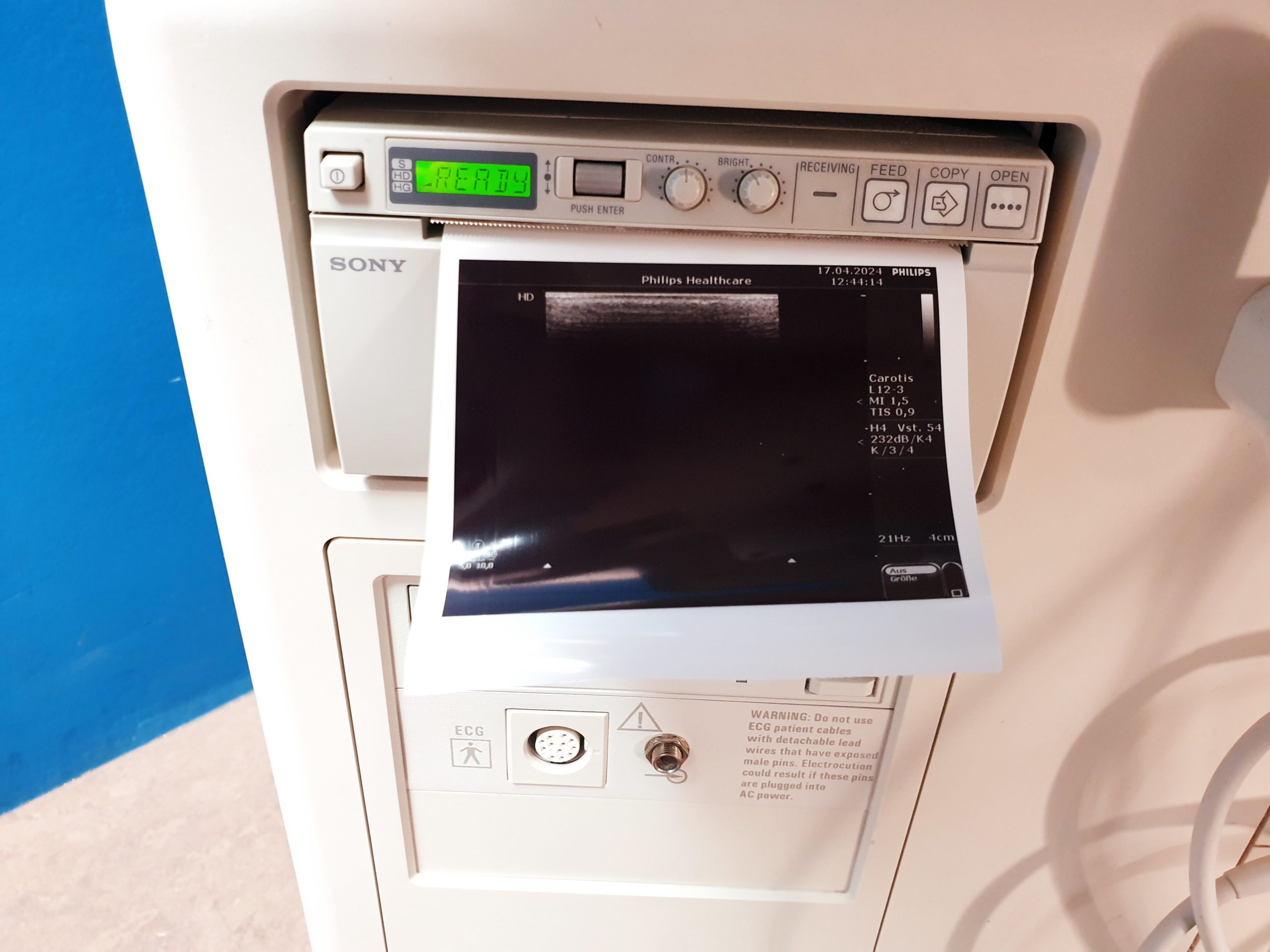 Philips HD7 Ultraschallgerät + S4-2 + L12-3 – Kardiomaschine thumbnail 8