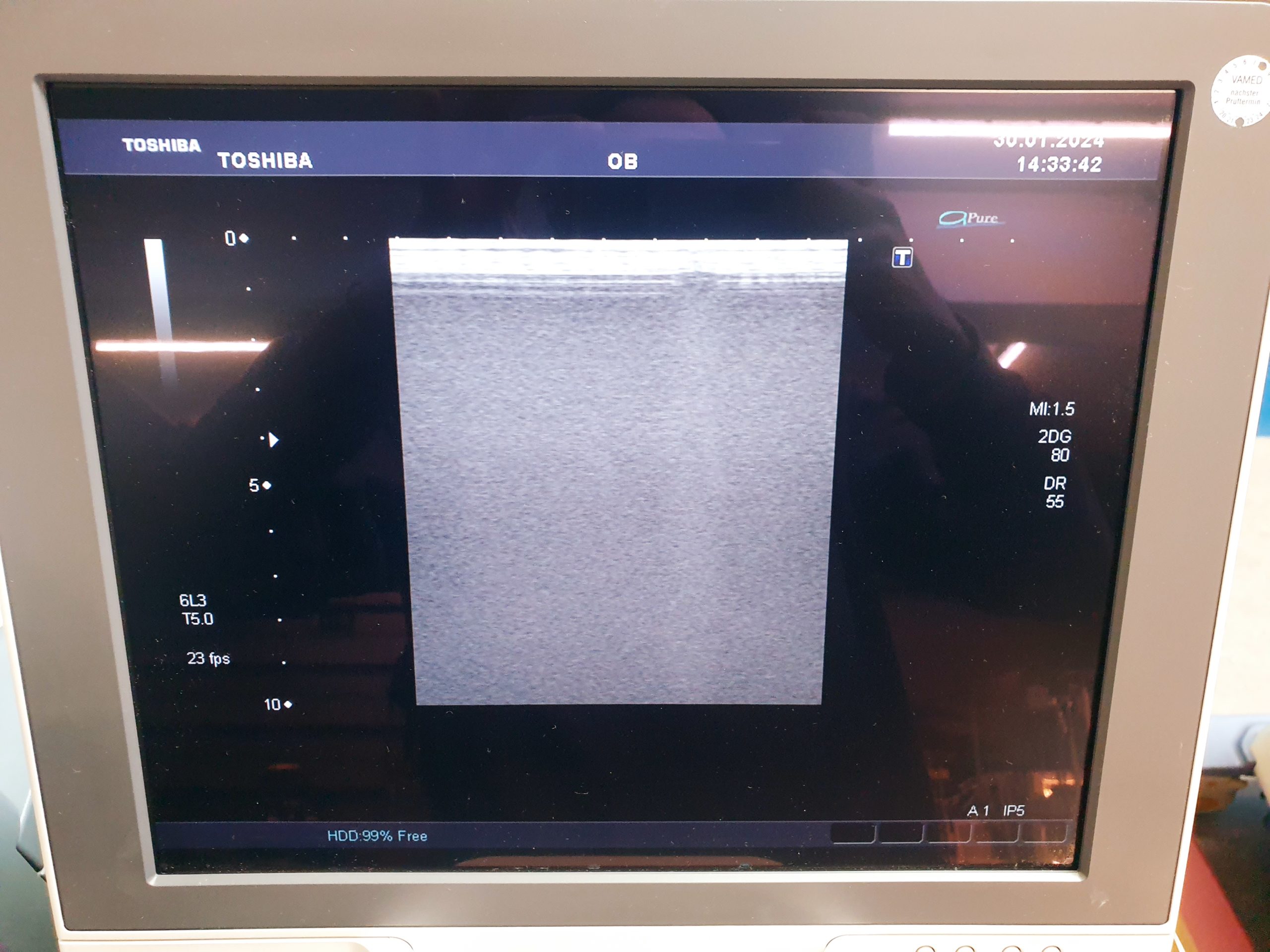 Toshiba PLT-308P Ultraschallsonde – Sonde thumbnail 5