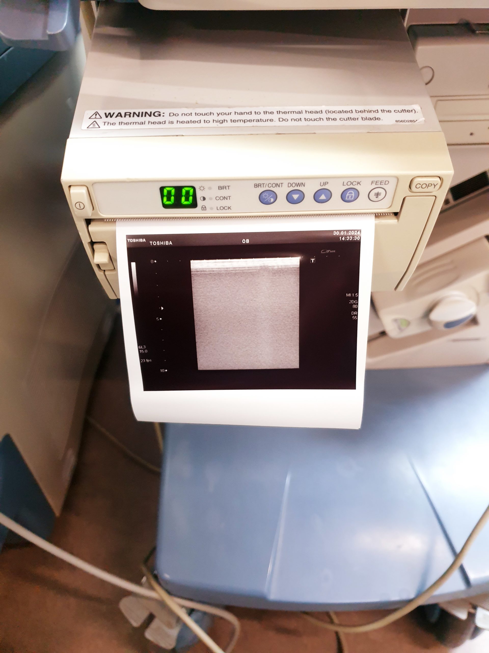Toshiba PLT-308P Ultraschallsonde – Sonde thumbnail 6