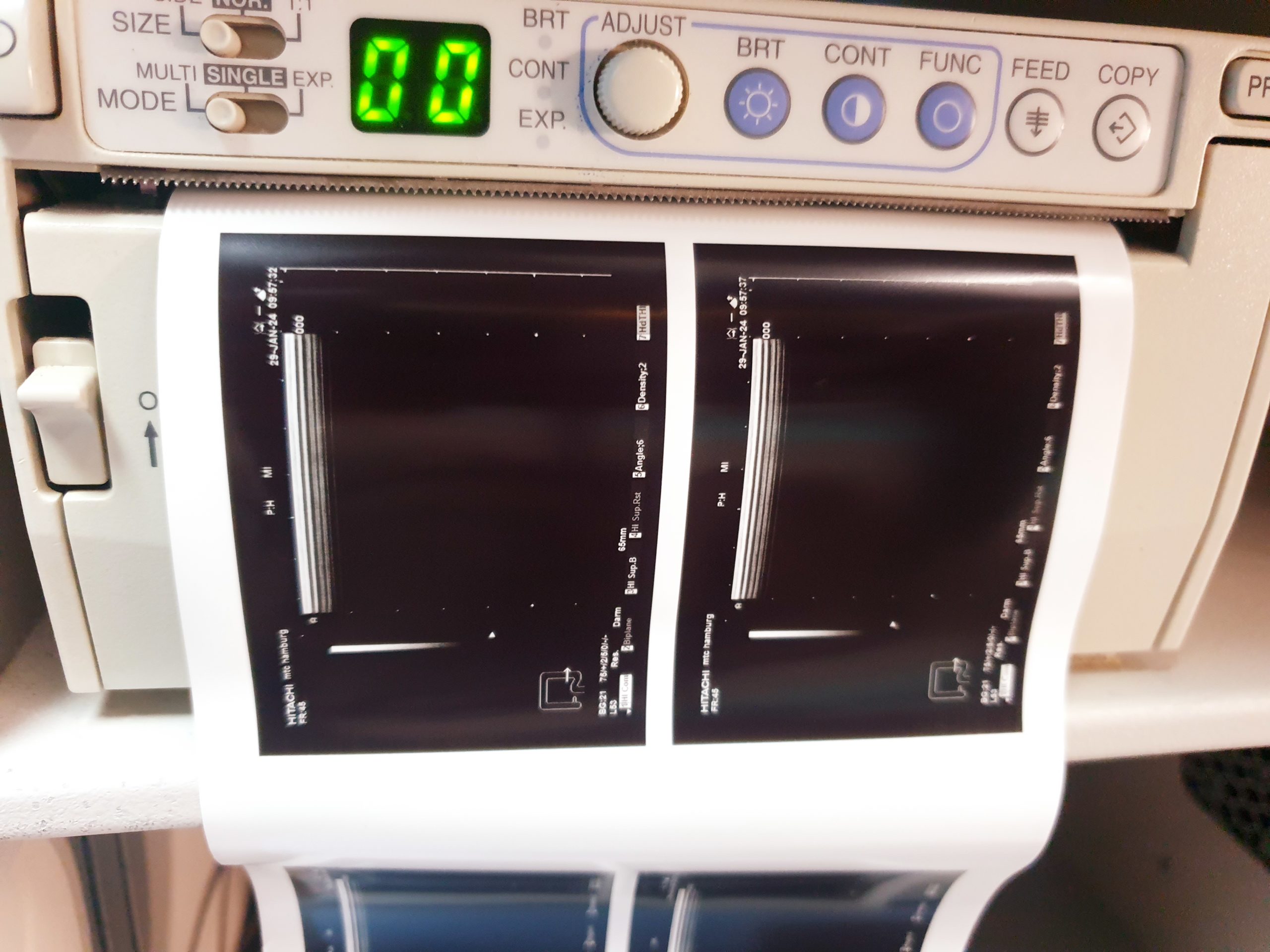 Hitachi EUB-8500 HV Ultraschallgerät Doppler + Konvex und Linear thumbnail 4