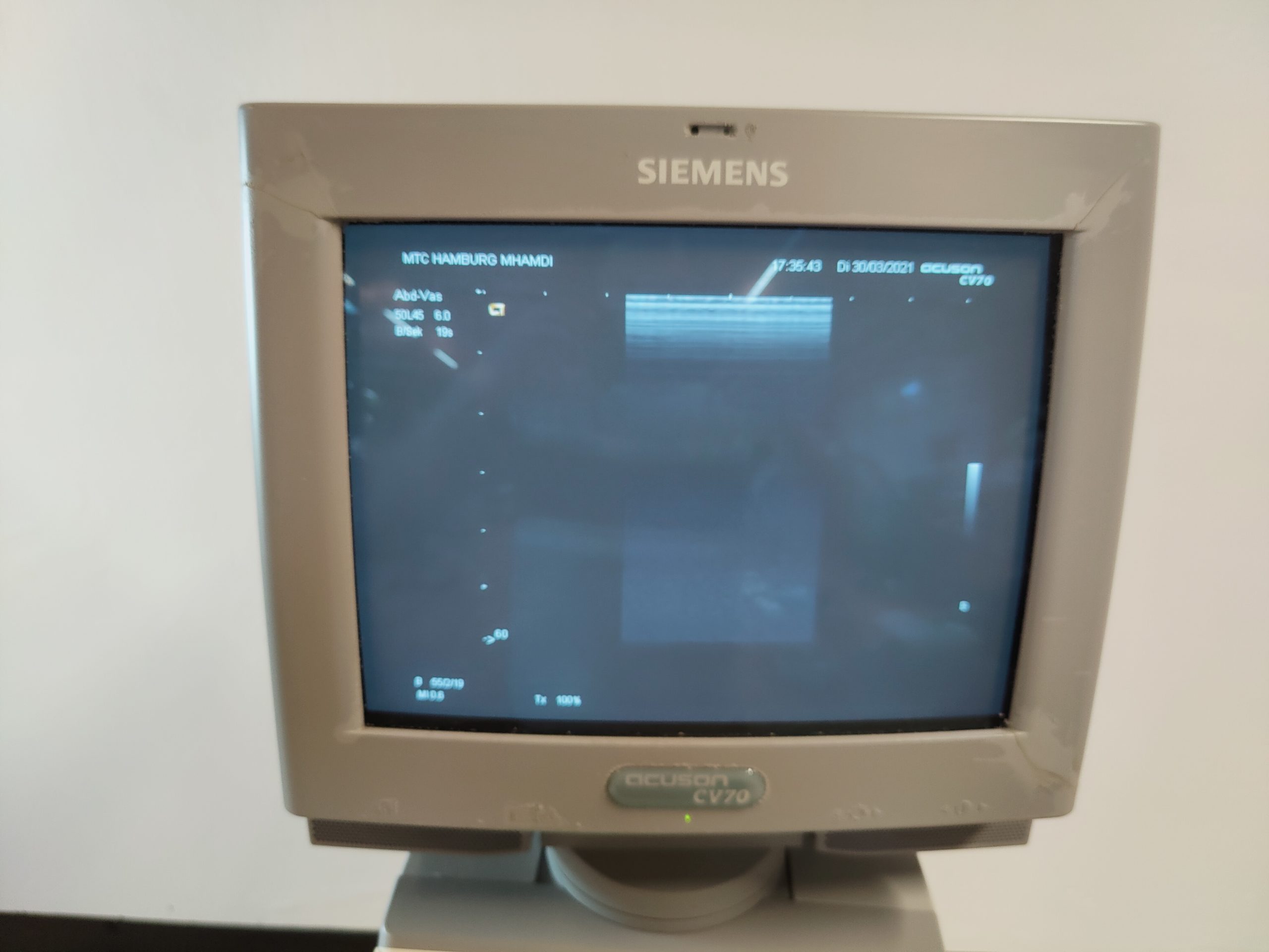 Siemens acuson CV70 // CV 70 C6-2 Konvex + 5.0L45 Linear + P4-2 Echo Kardio thumbnail 3