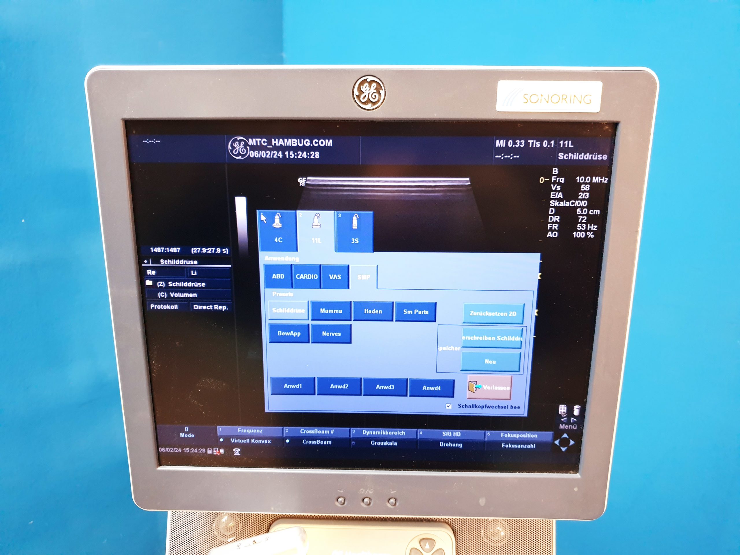 GE Logiq P6 Pro -4C + 11L + 3S + Printer thumbnail 8