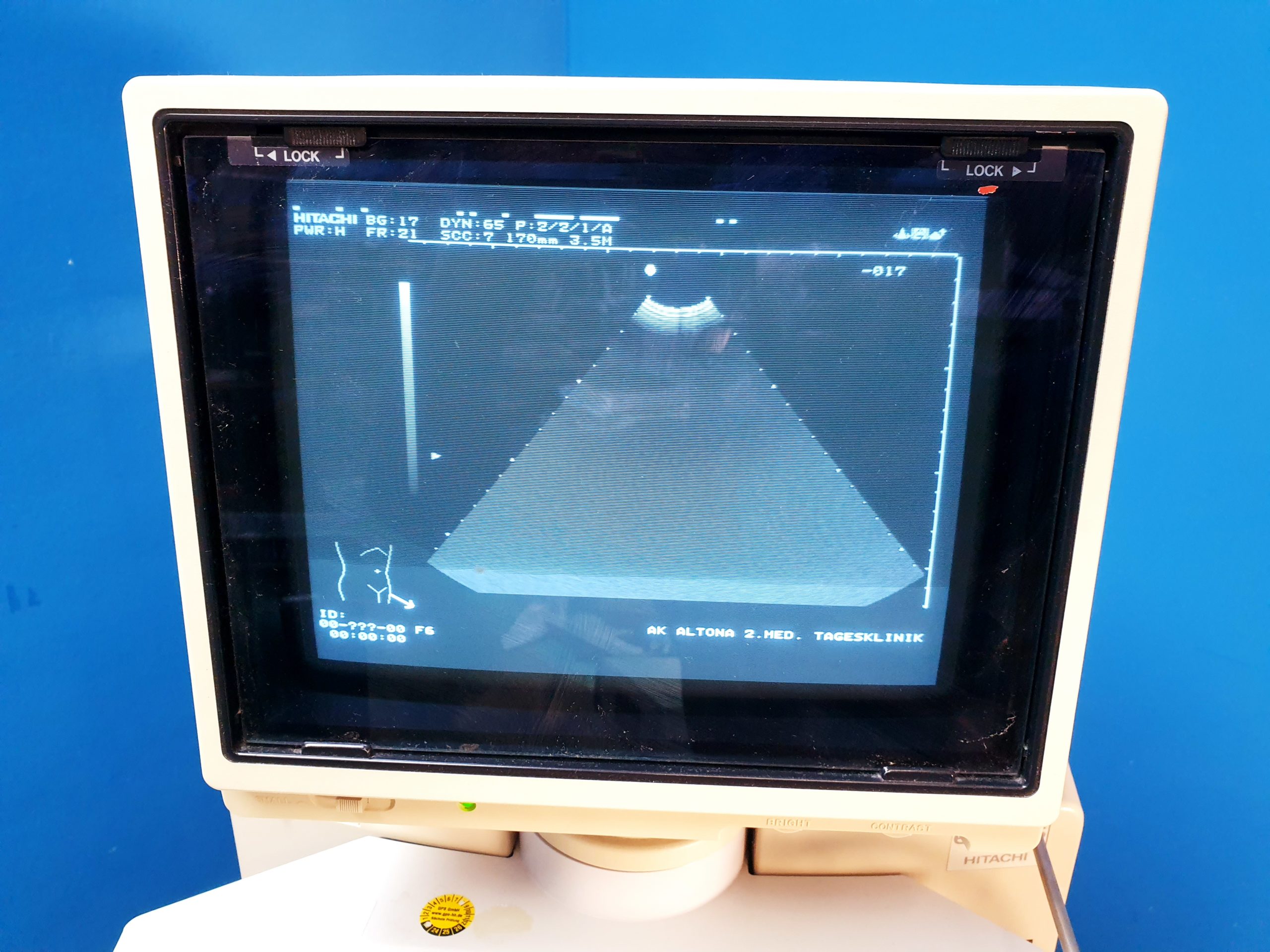 Hitachi EUB-525 Ultraschallgerät – mit Konvex und Linear thumbnail 4