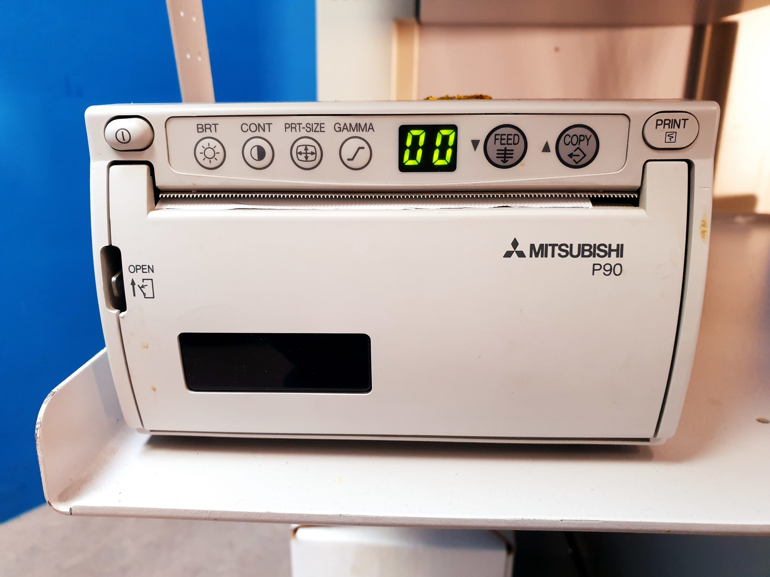 Hitachi EUB-525 Ultraschallgerät – mit Konvex und Linear thumbnail 5