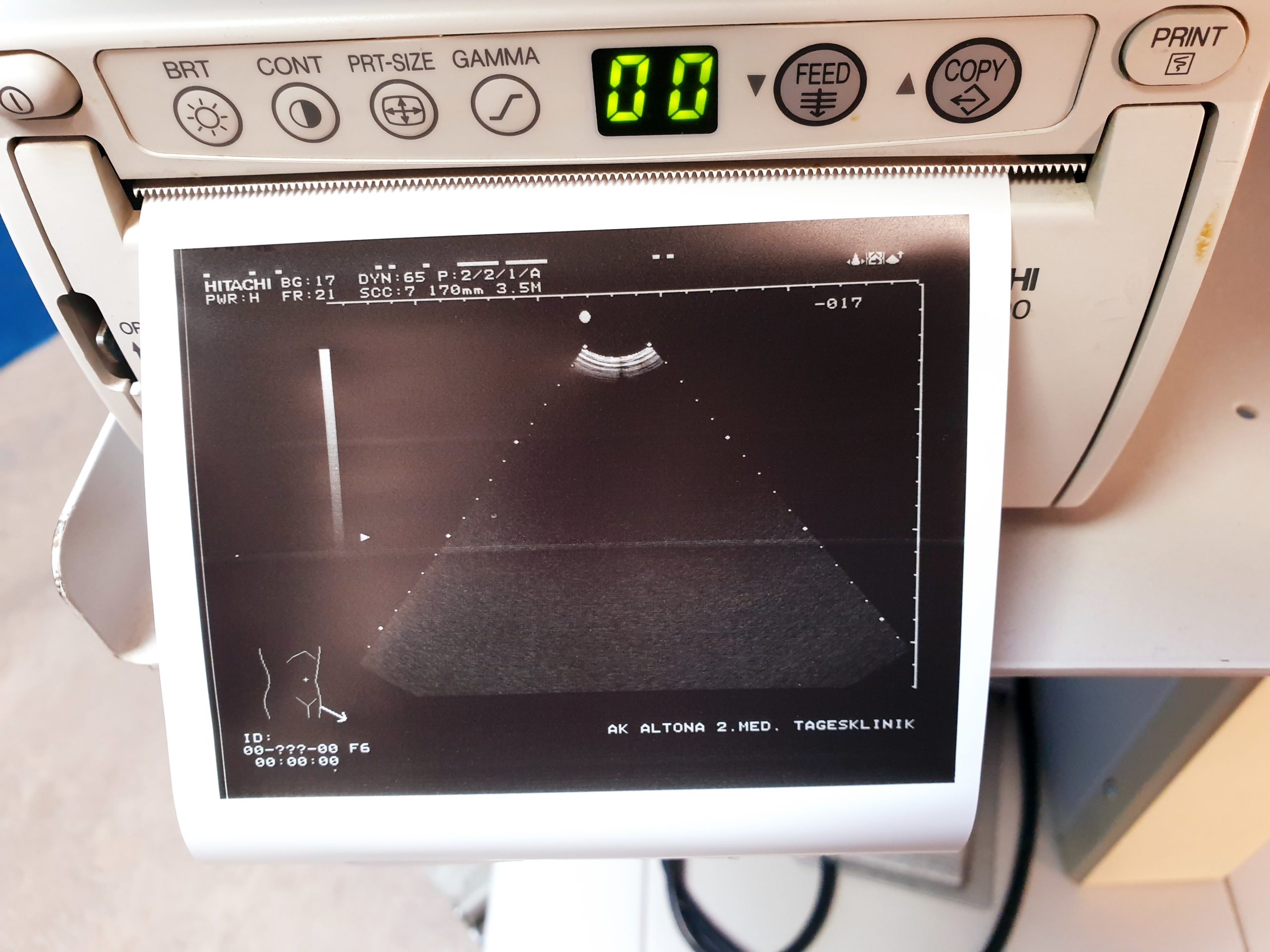 Hitachi EUB-525 Ultraschallgerät – mit Konvex und Linear thumbnail 6