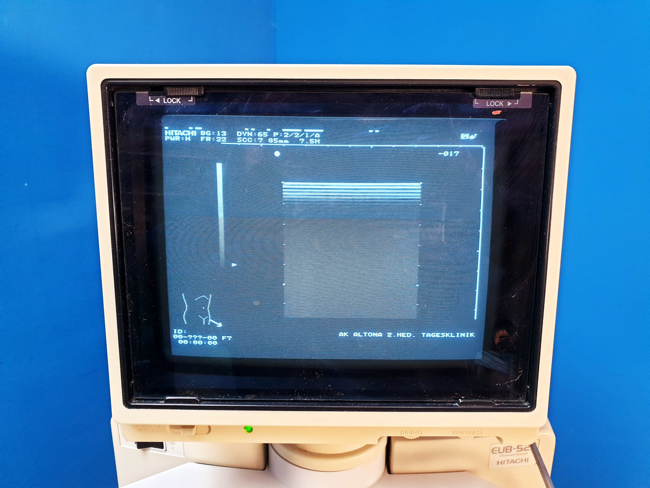 Hitachi EUB-525 Ultraschallgerät – mit Konvex und Linear thumbnail 10