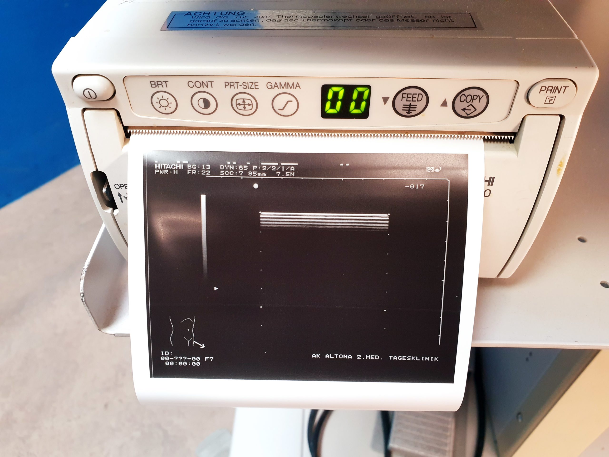 Hitachi EUB-525 Ultraschallgerät – mit Konvex und Linear thumbnail 11